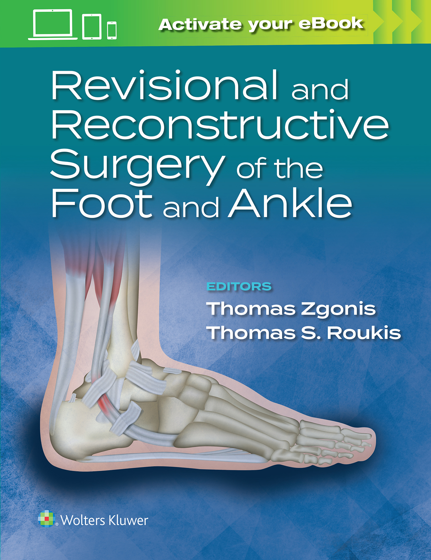 Revisional and Reconstructive Surgery of the Foot and Ankle by Thomas