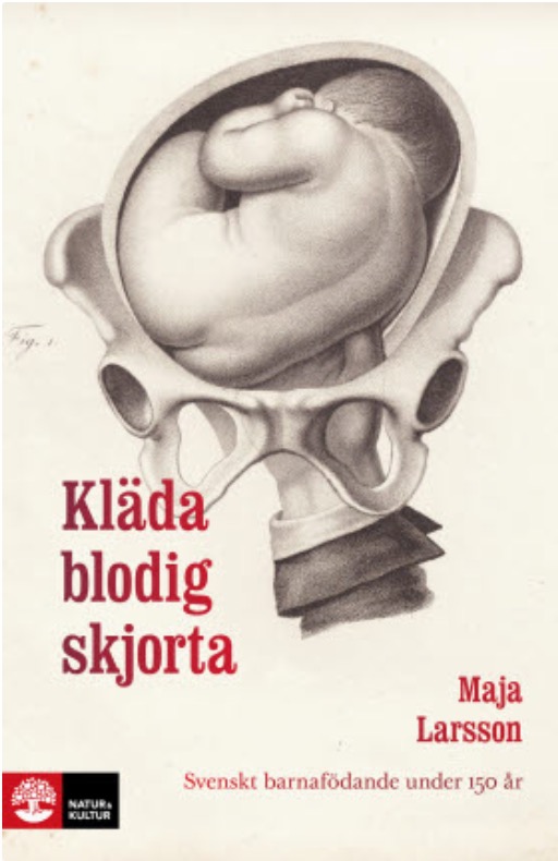 Kläda blodig skjorta: svenskt barnafödande under 150 år