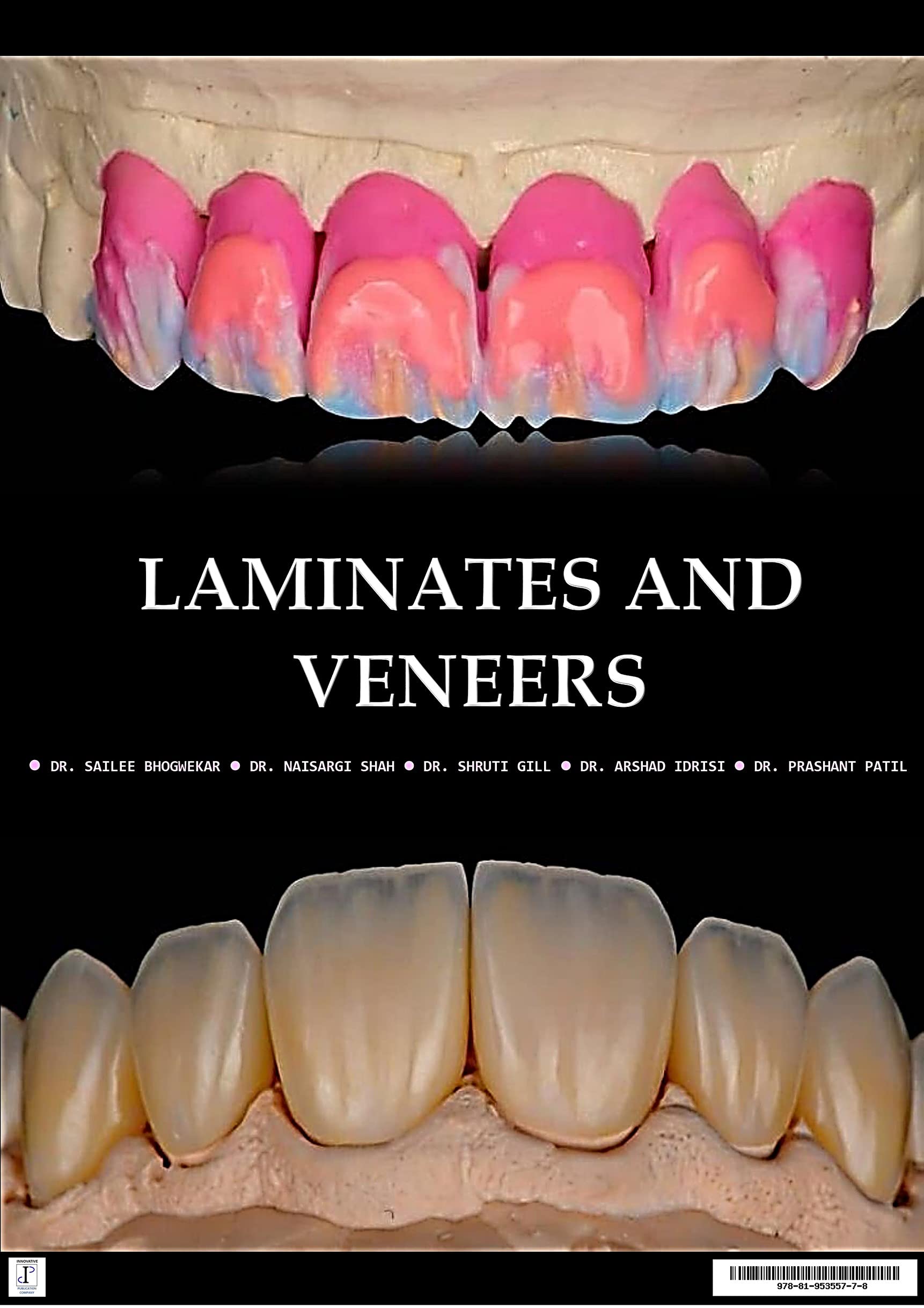 Laminates and Veneers by Dr.Sailee Bhogwekar Goodreads