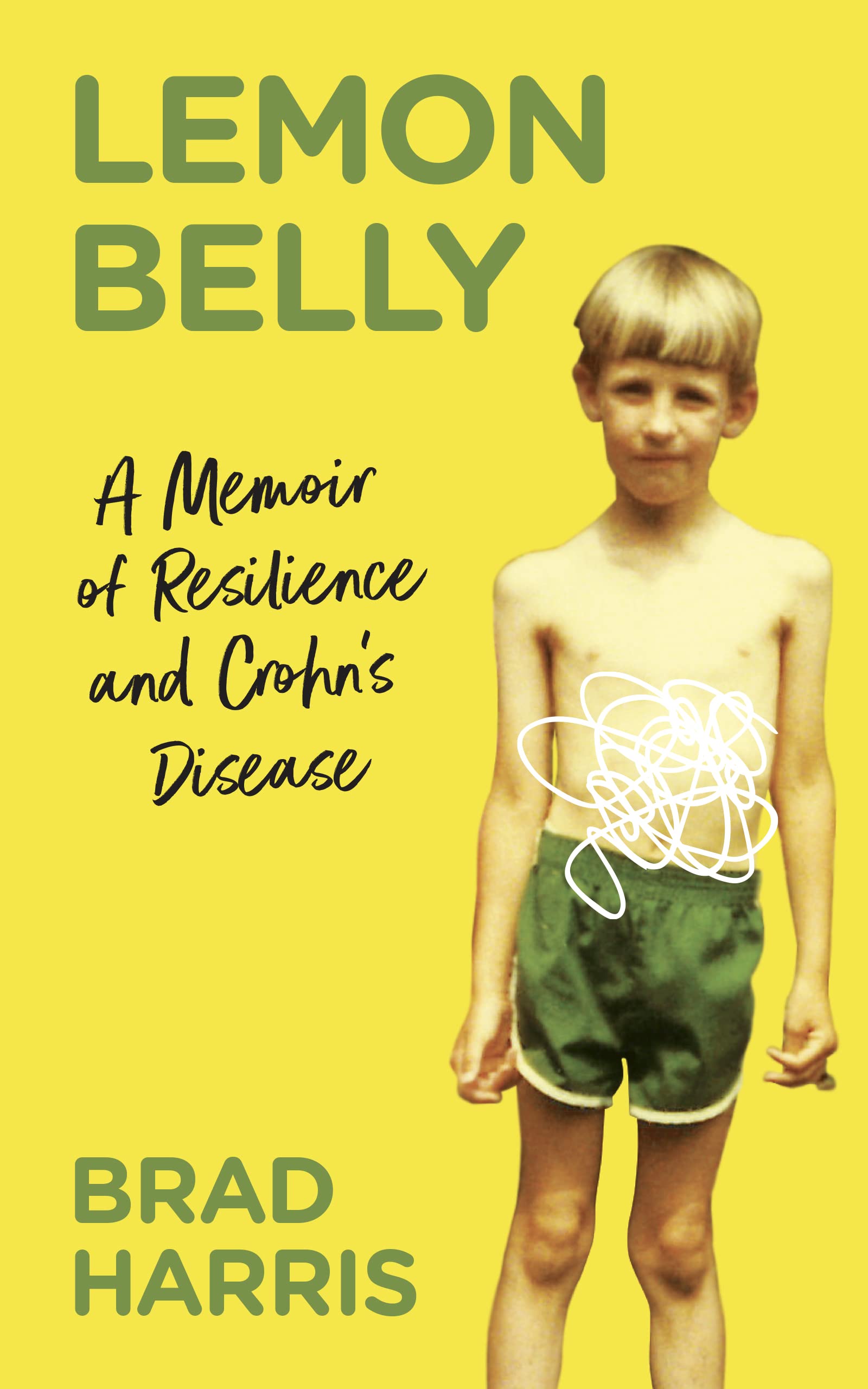 Lemon Belly: A Memoir of Resilience and Crohn's Disease