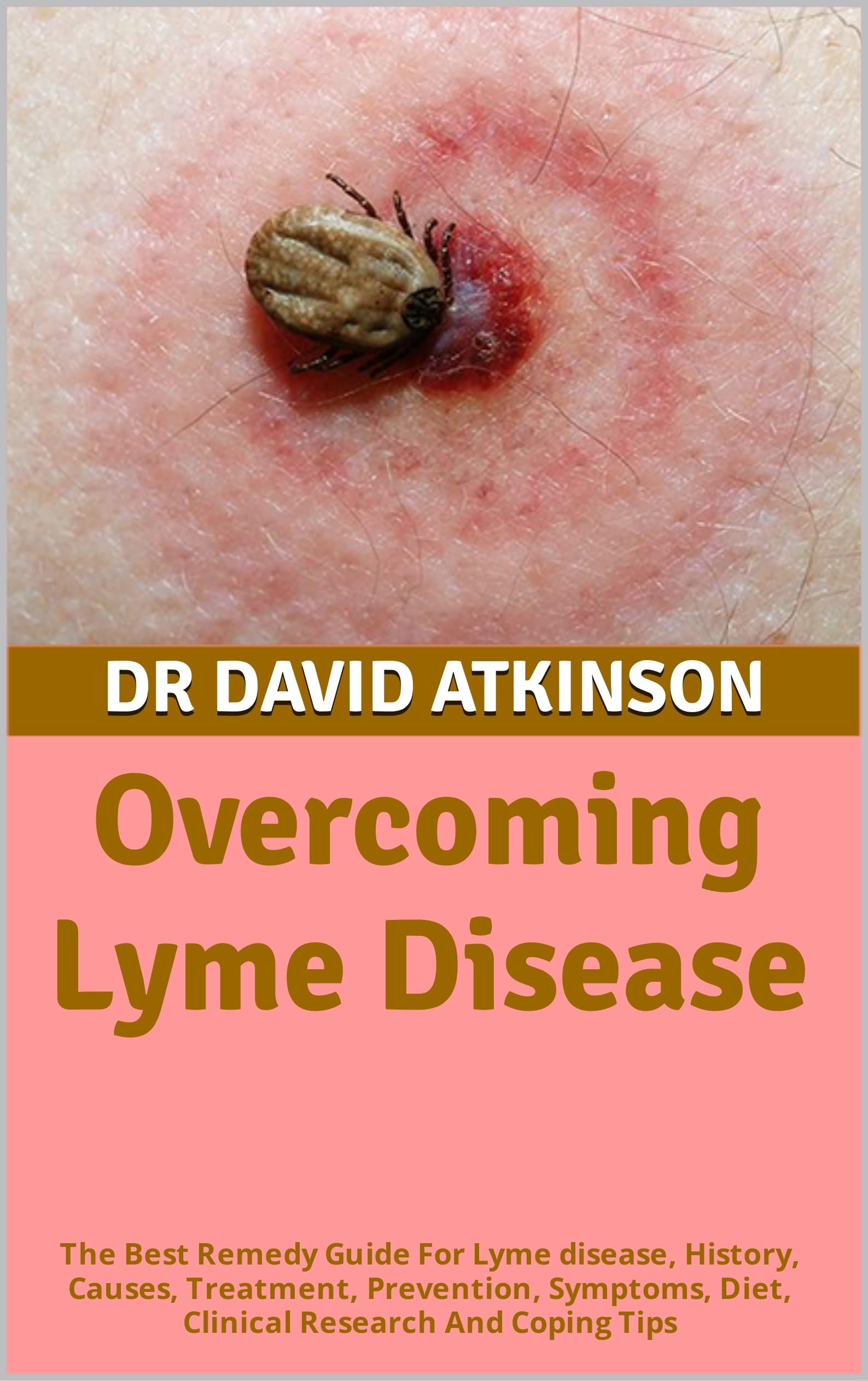 Lyme Disease The Best Remedy Guide For Lyme disease