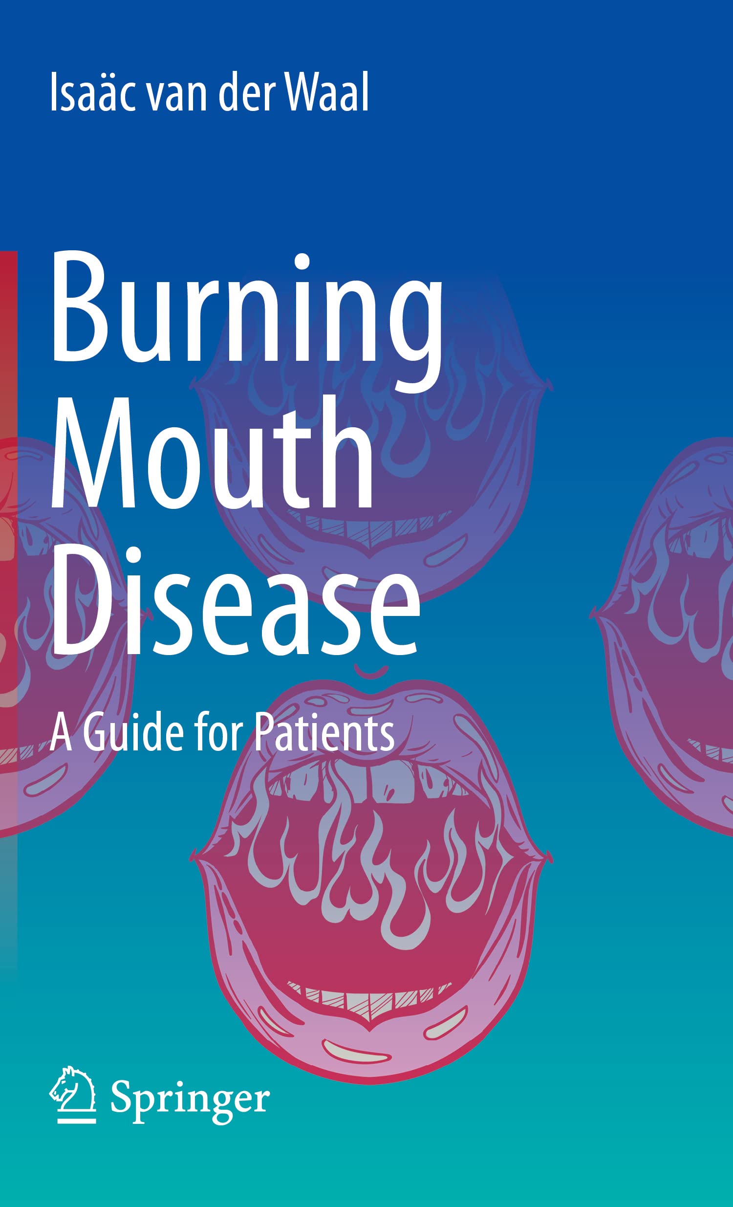 Burning Mouth Disease A Guide for Patients by Isaäc van der Waal