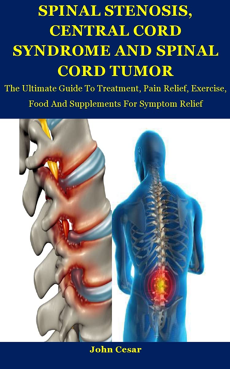 Spinal Stenosis, Central Cord Tumor And Spinal Cord Syndrome The