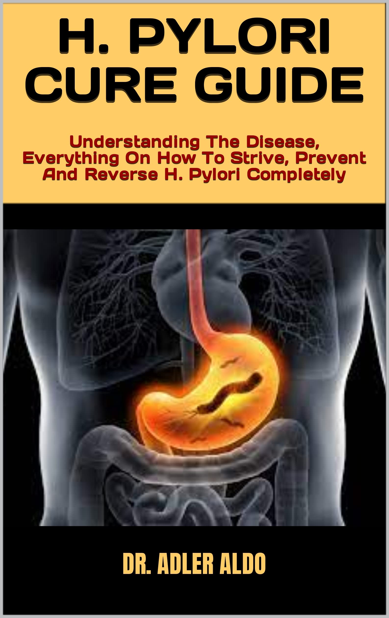 H. PYLORI CURE GUIDE Understanding The Disease, Everything On How To
