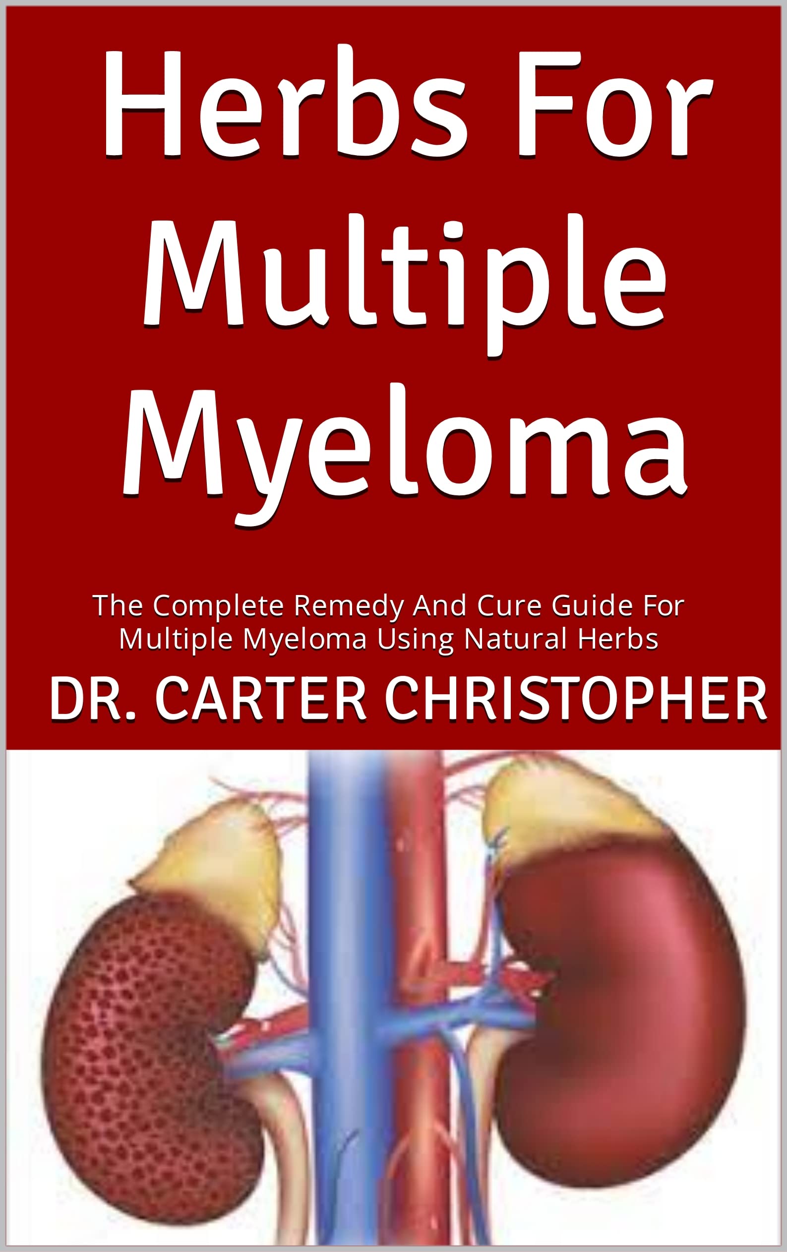 Herbs For Multiple Myeloma The Complete Remedy And Cure Guide For