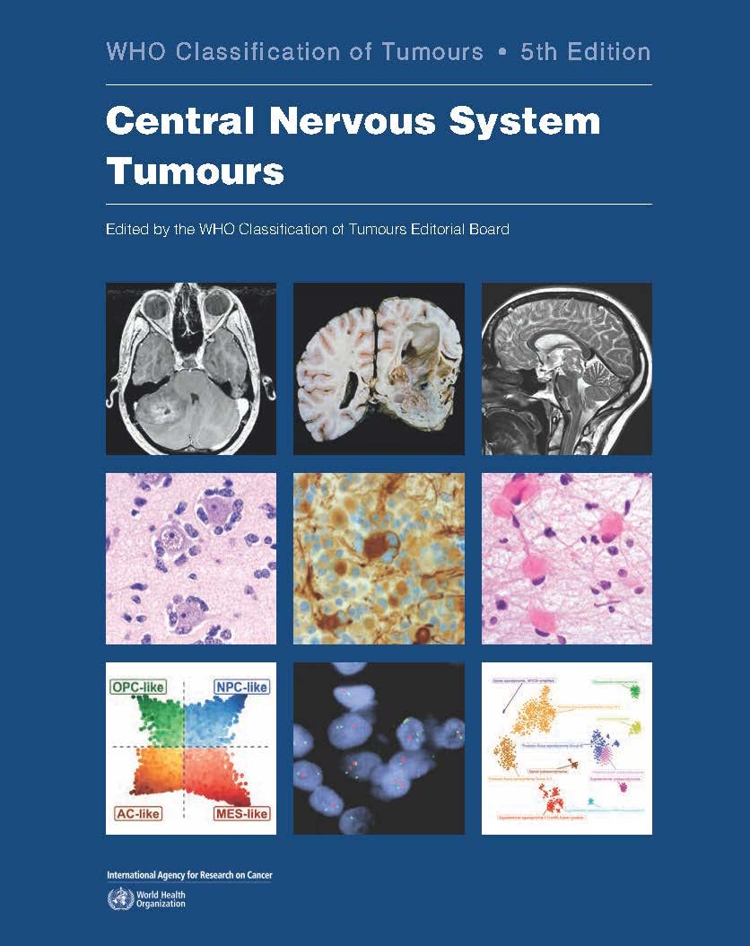 central-nervous-system-tumours-who-classification-of-tumours-by-who