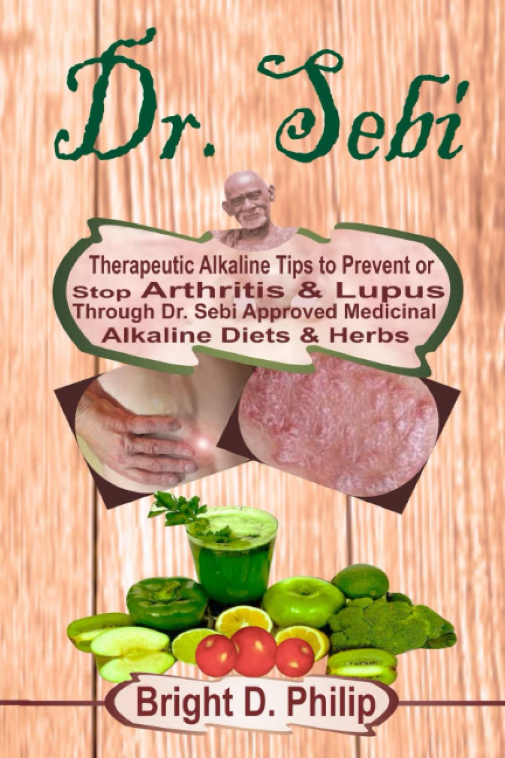 Dr. Sebi: Therapeutic Alkaline Tips to Prevent or Stop Arthritis