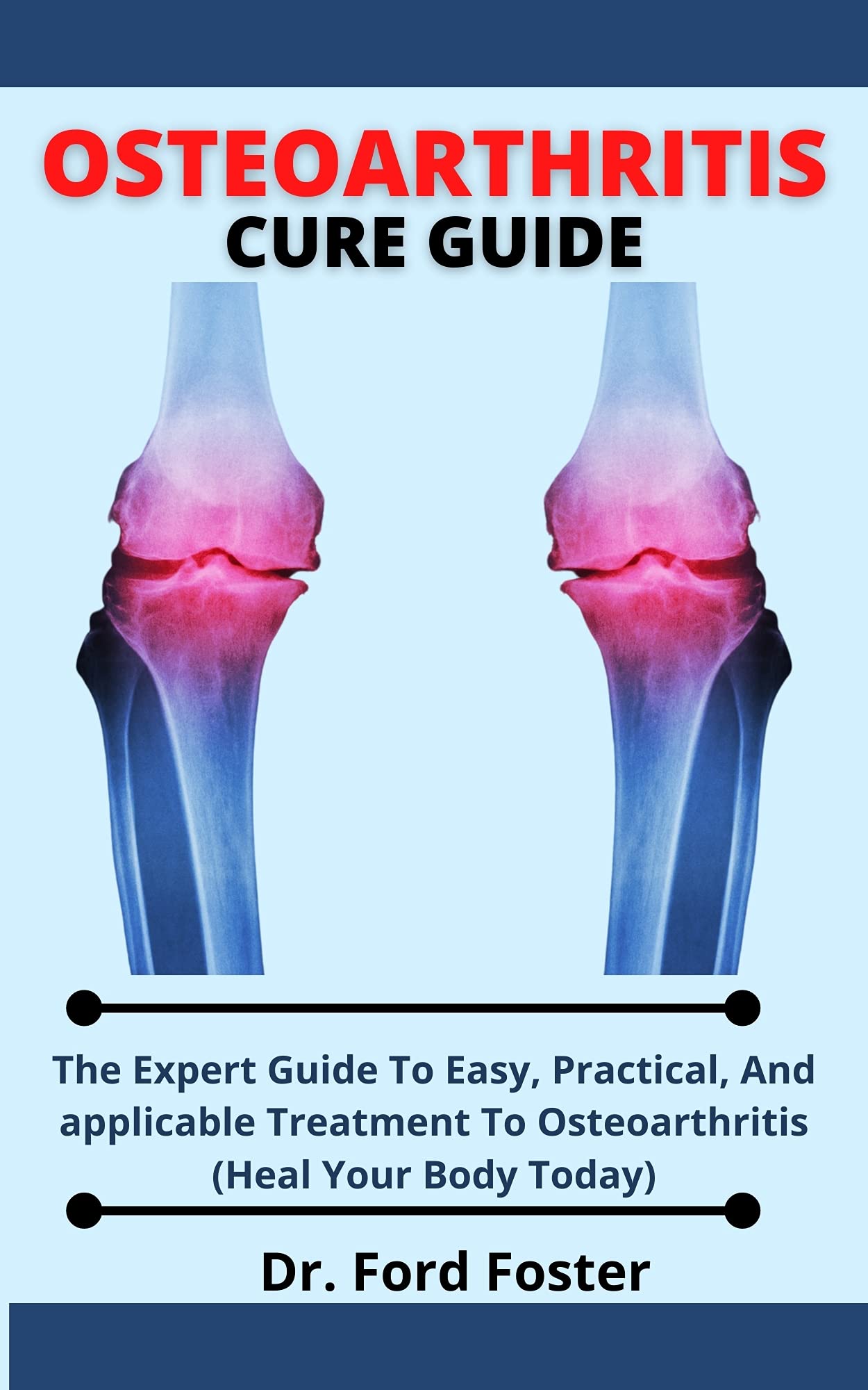 Osteoarthritis Cure Guide The Expert Guide To Easy, Practical And