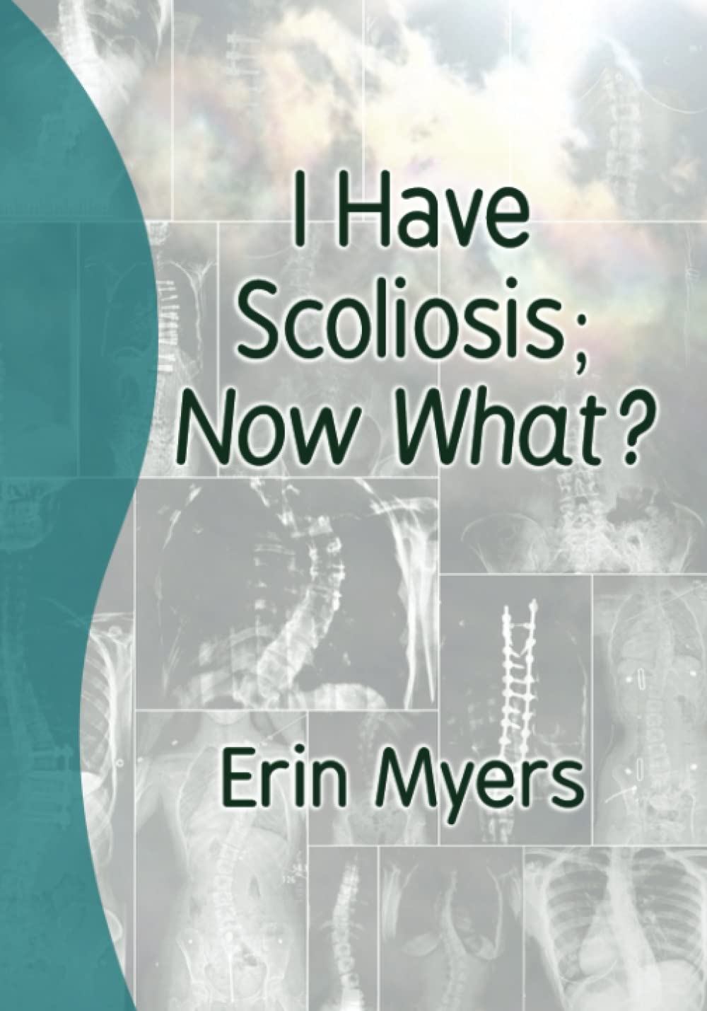 I Have Scoliosis; Now What? by Erin Myers Goodreads