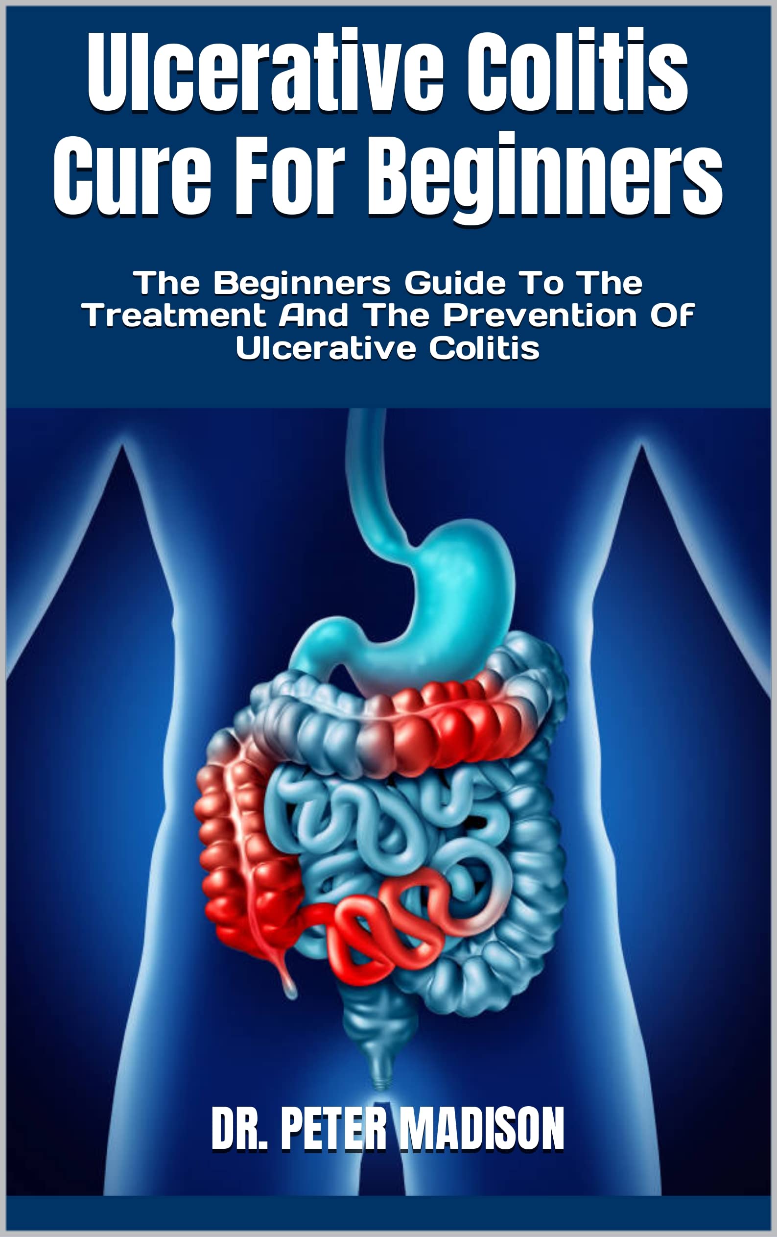 Ulcerative Colitis Cure For Beginners The Beginners Guide To The