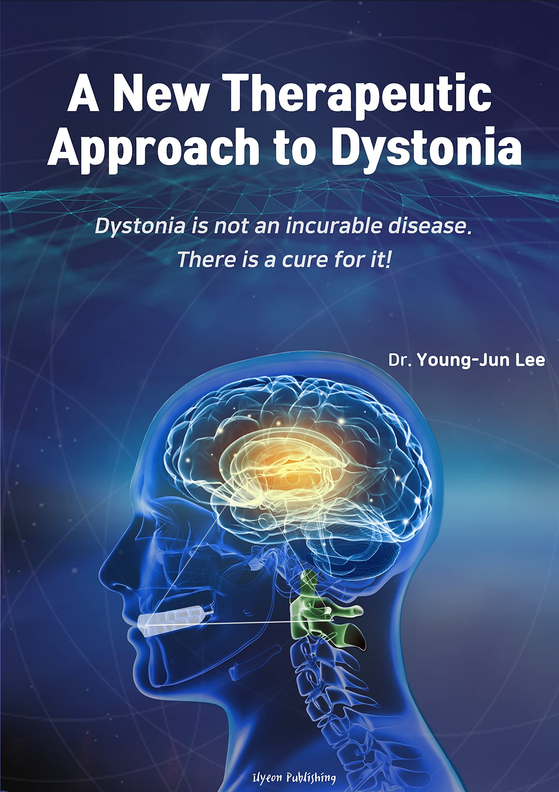 Is This The End For Dystorra? (The Leak Reveals...) - p400tcn