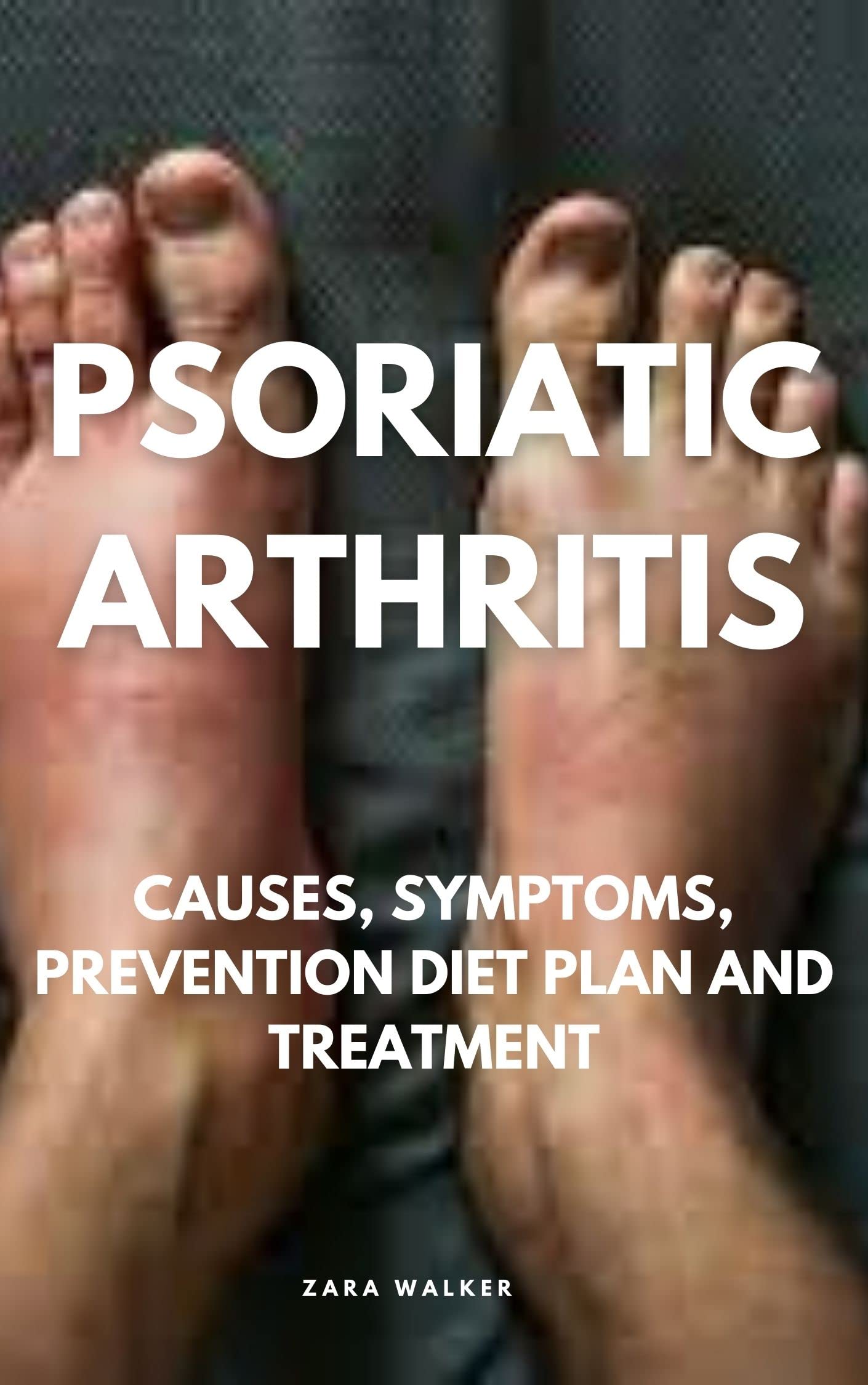 PSORIATIC ARTHRITIS CAUSES, SYMPTOMS, PREVENTION DIET PLAN AND