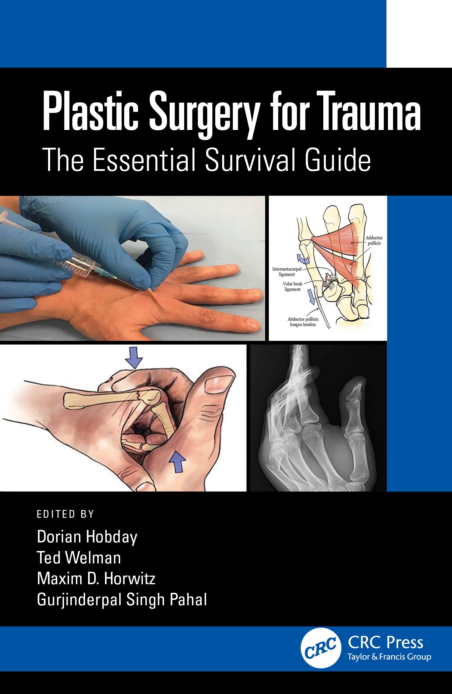 Plastic Surgery for Trauma The Essential Survival Guide by Ted Welman