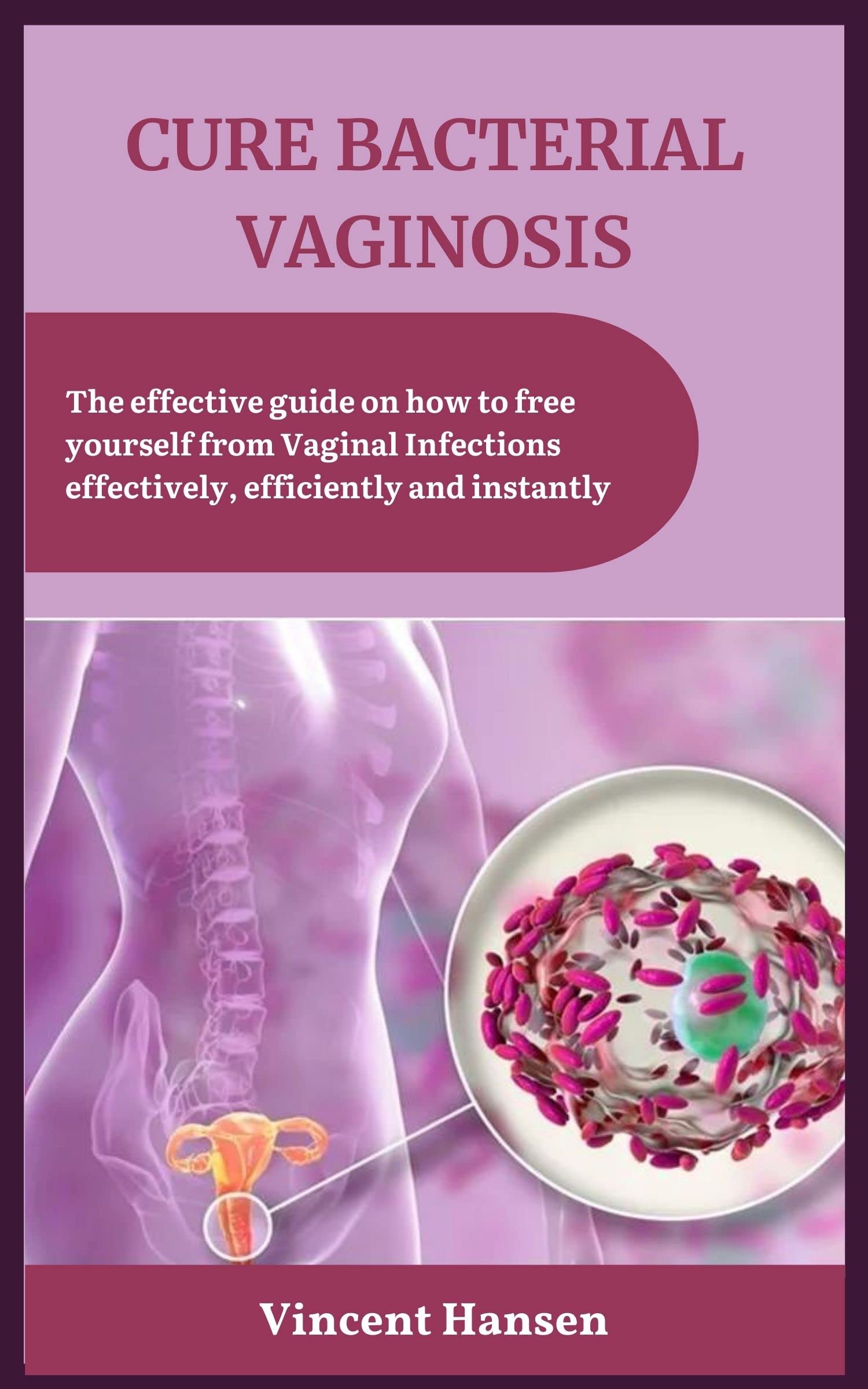 CURE BACTERIAL VAGINOSIS The Effective Guide On How To Free Yourself 62018018