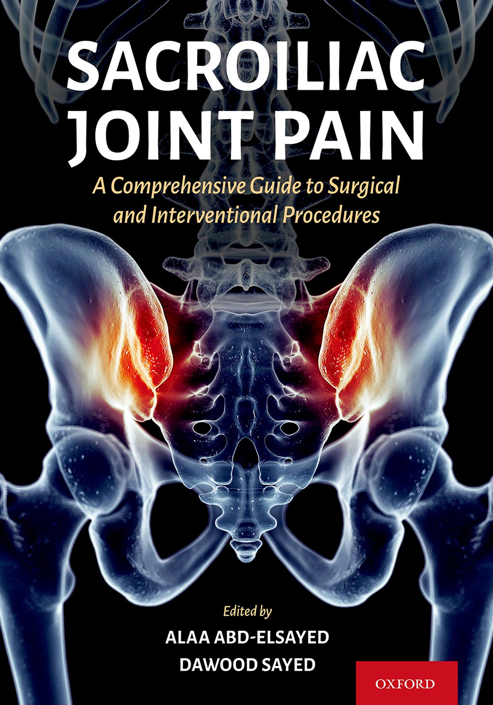 Sacroiliac Joint Pain A Comprehensive Guide to Interventional and
