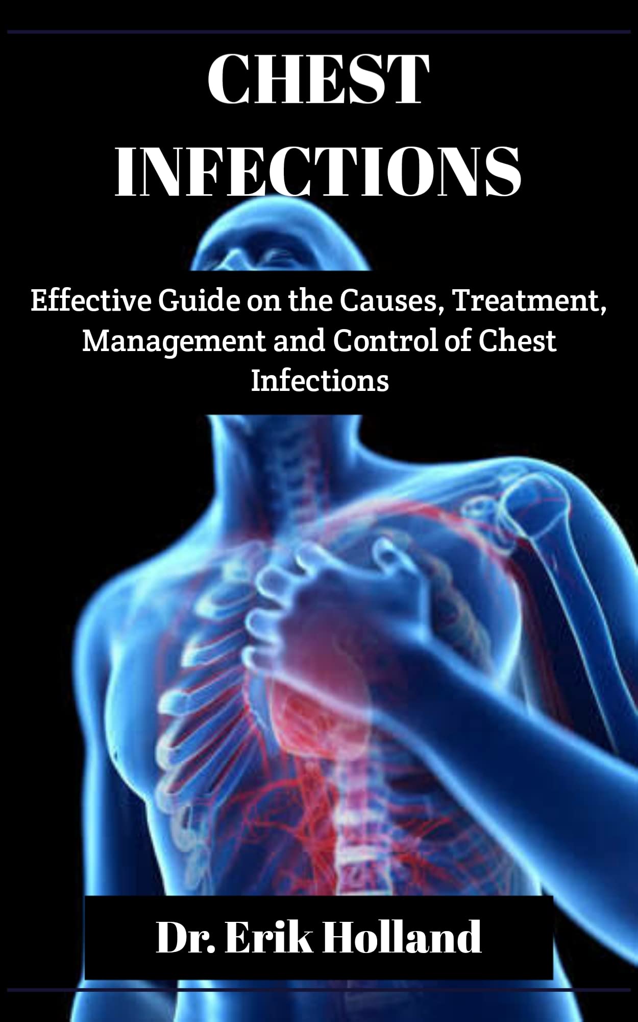 CHEST INFECTIONS Effective Guide on the Causes, Treatment, Management and Controls of Chest
