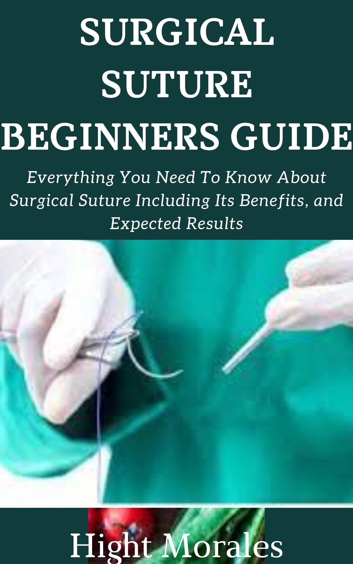 SURGICAL SUTURE BEGINNERS GUIDE Everything You Need To Know About Surgical Suture Including Its