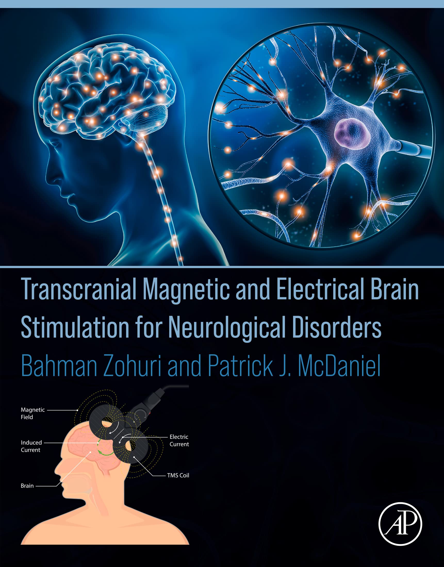 Transcranial and Electrical Brain Stimulation for Neurological