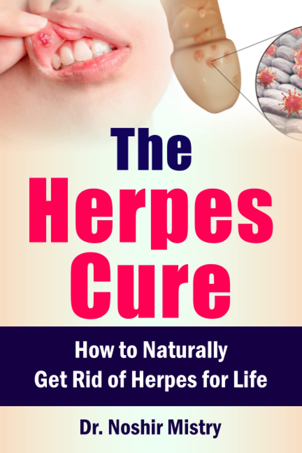 the-herpes-cure-how-to-naturally-get-rid-of-herpes-for-life-by-dr