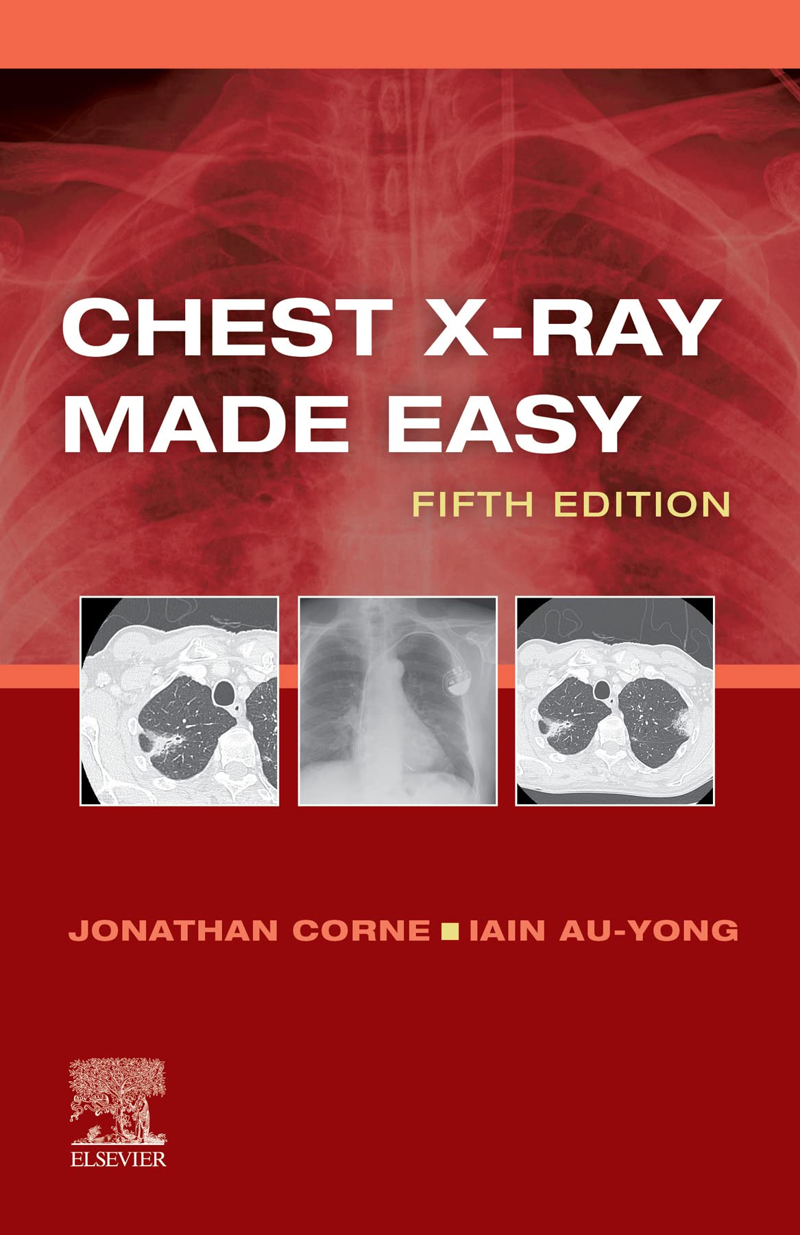 Chest XRay Made Easy Chest XRay Made Easy EBook by Jonathan Corne