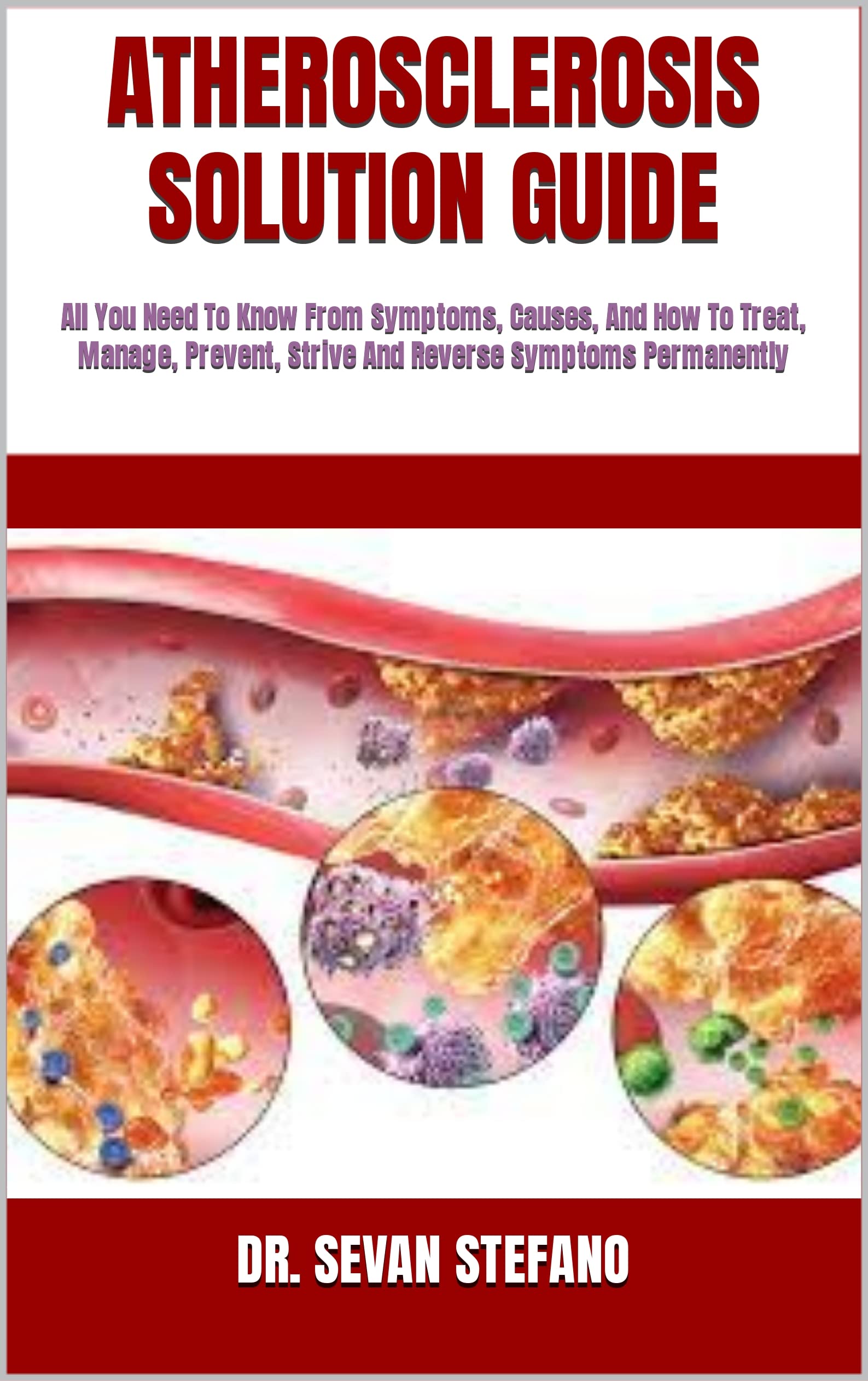 ATHEROSCLEROSIS SOLUTION GUIDE All You Need To Know From Symptoms