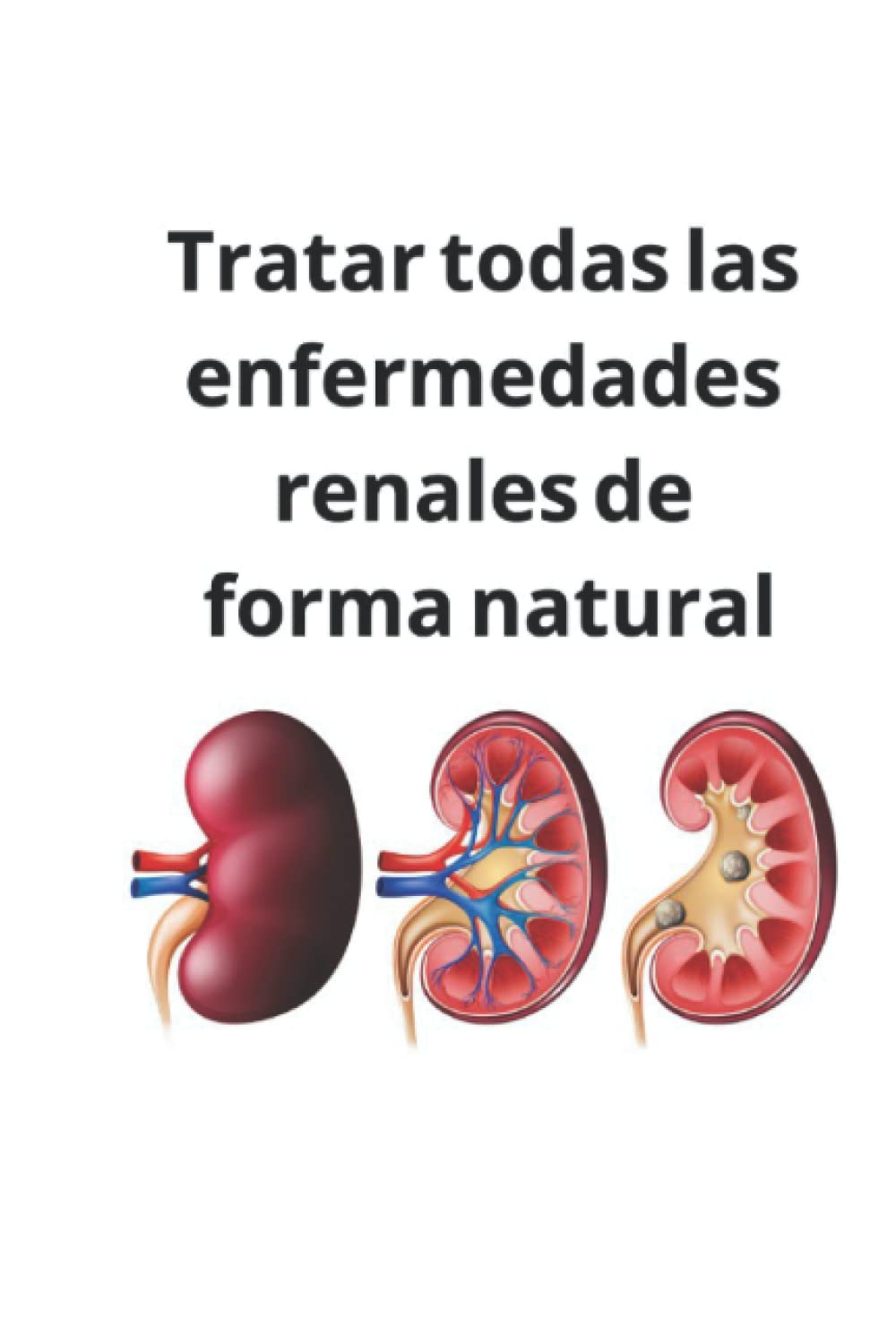 Tratar todas las enfermedades renales de forma natural DR.Sebi by dr