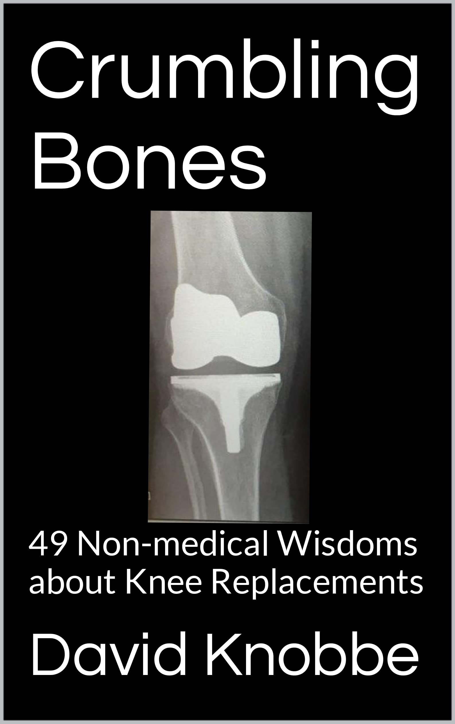 Crumbling Bones 49 Nonmedical Wisdoms about Knee Replacements by