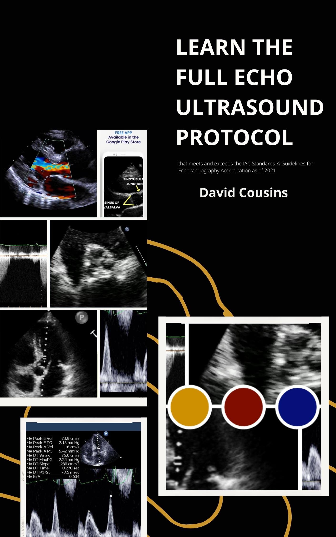 LEARN THE FULL ECHO TTE ECHOCARDIOGRAM ULTRASOUND PROTOCOL meets and