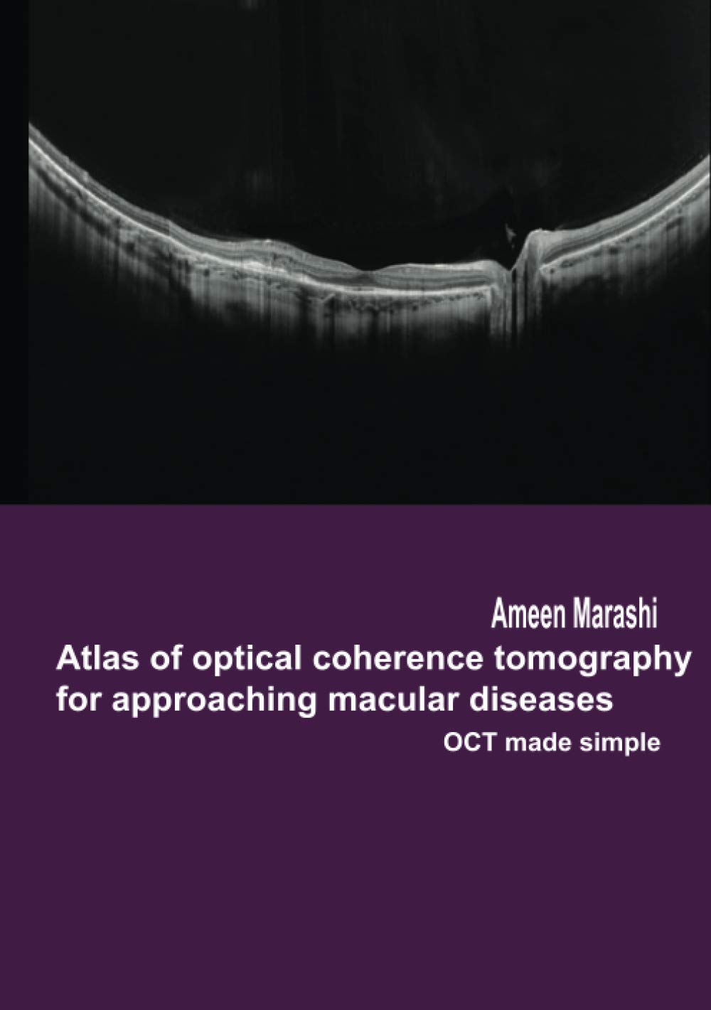 Atlas of optical coherence tomography for approaching macular diseases