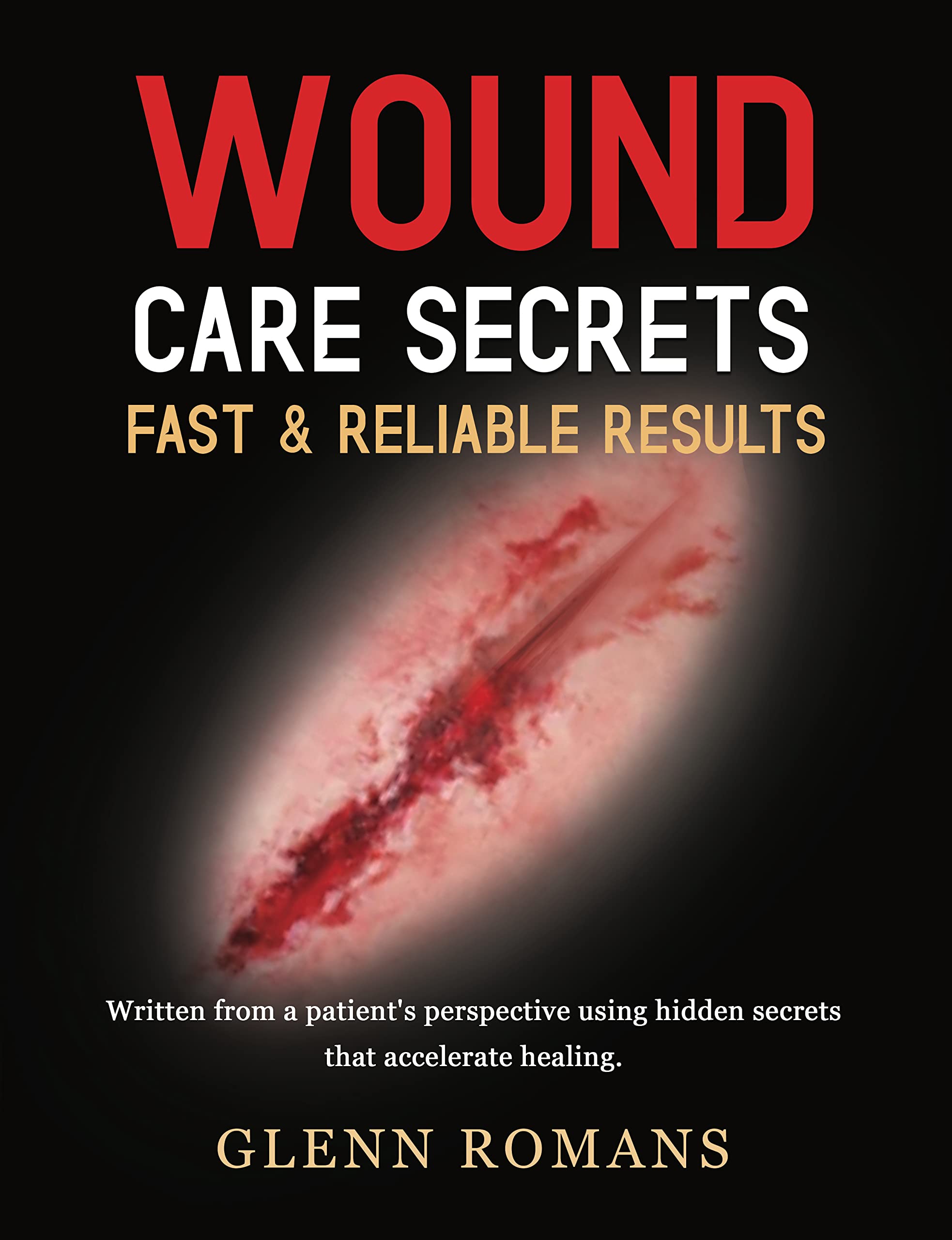 Weeping Wounds: A Comprehensive Guide For Faster Healing - 4qzx5gf
