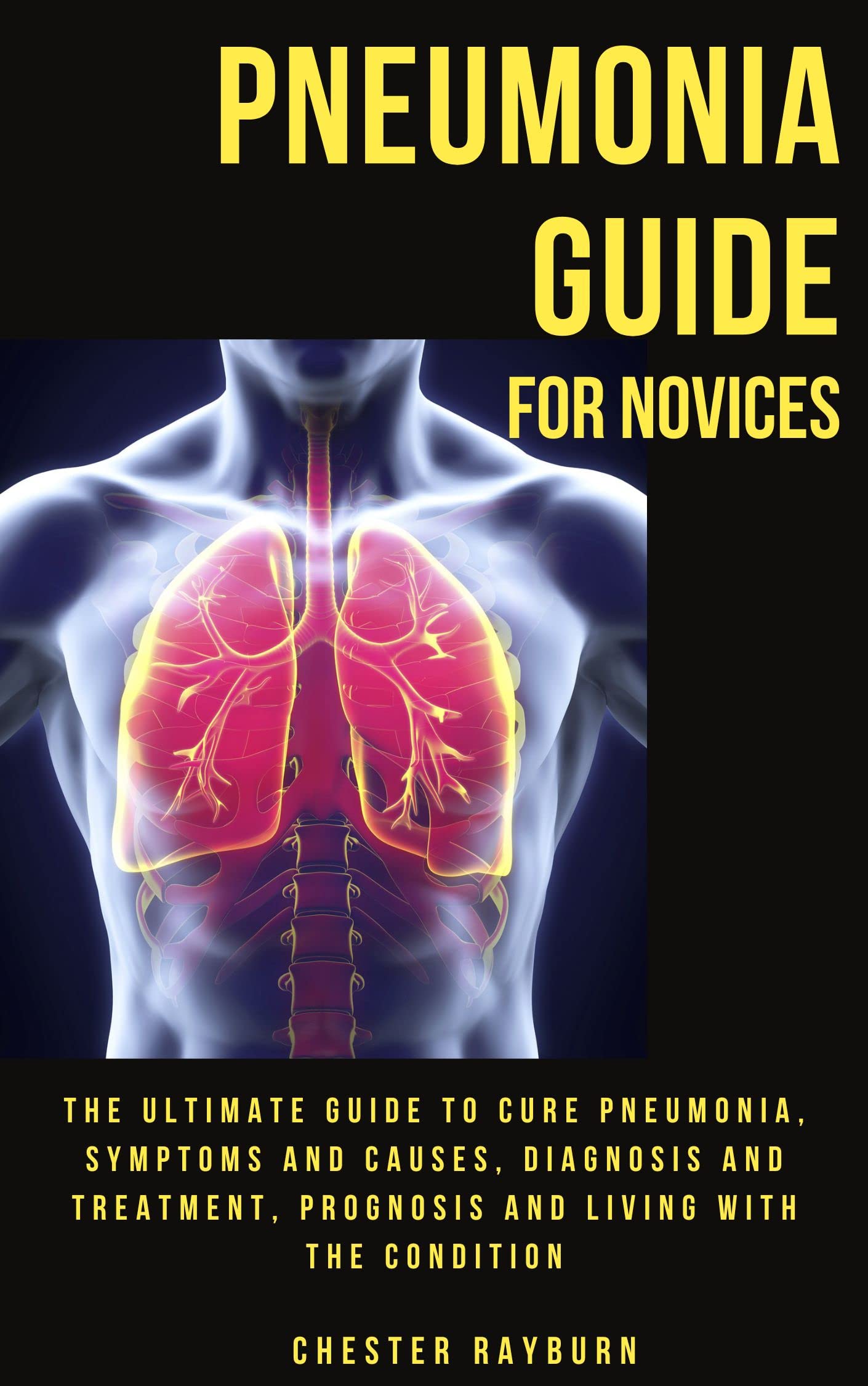 PNEUMONIA GUIDE FOR NOVICES The ultimate guide to cure pneumonia