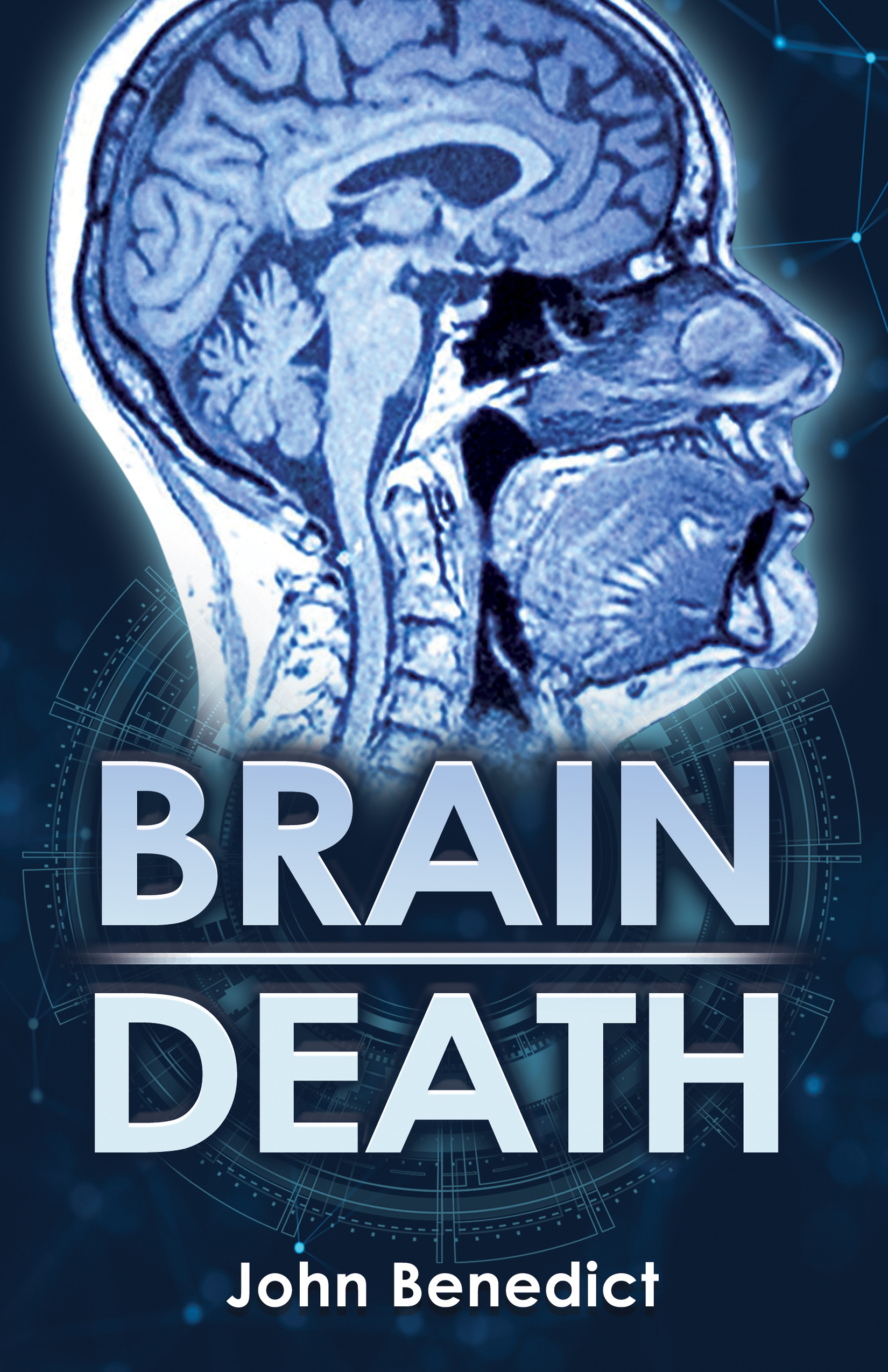 Brain Death