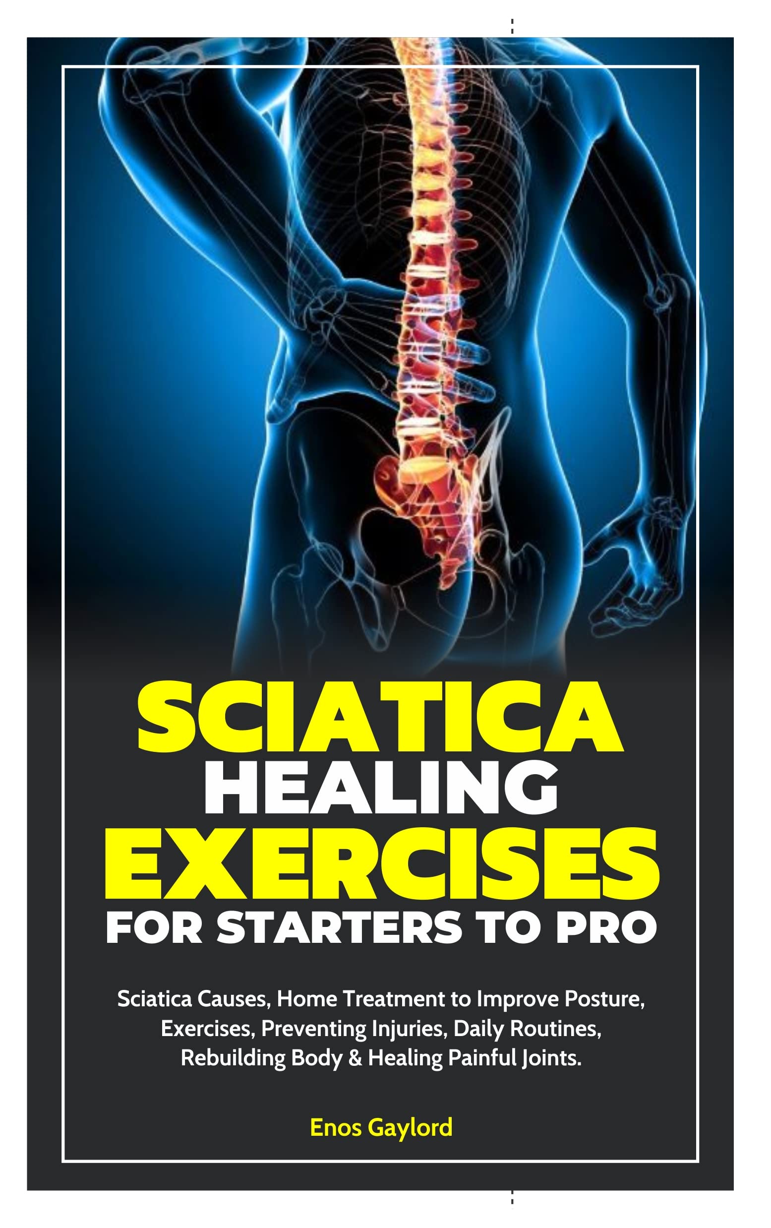 SCIATICA HEALING EXERCISES FOR STARTERS TO PRO Sciatica Causes, Home
