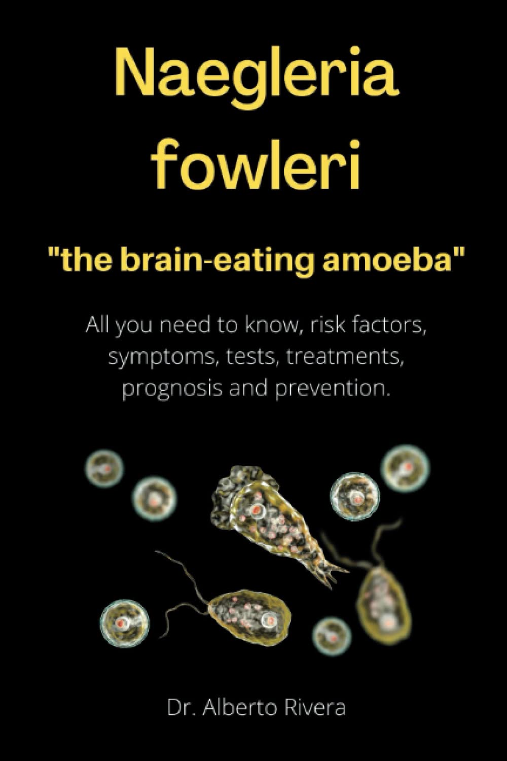 Naegleria fowleri, the braineating amoeba. All you need to know, risk