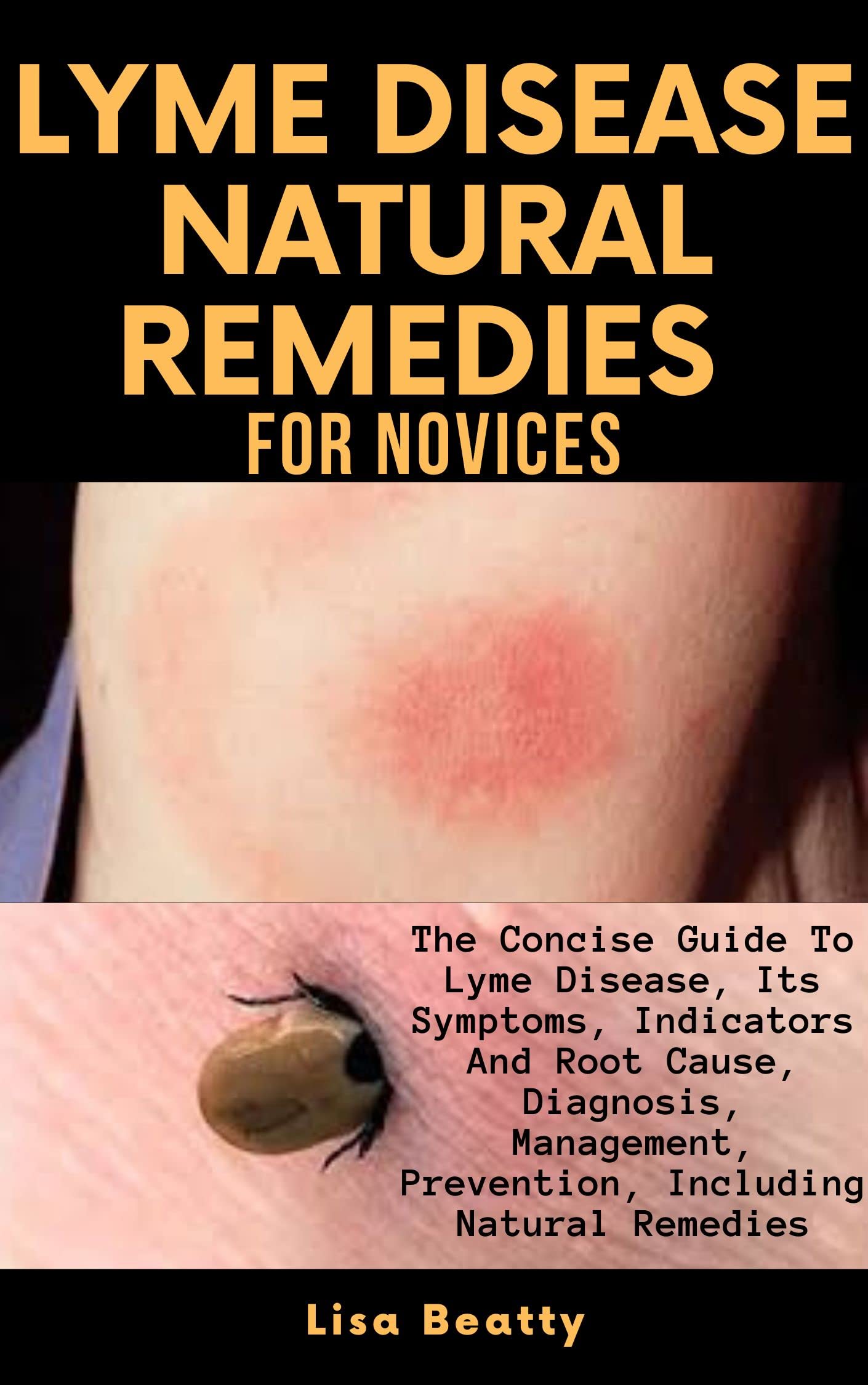 LYME DISEASE NATURAL REMEDIES FOR NOVICES The Concise Guide To Lyme