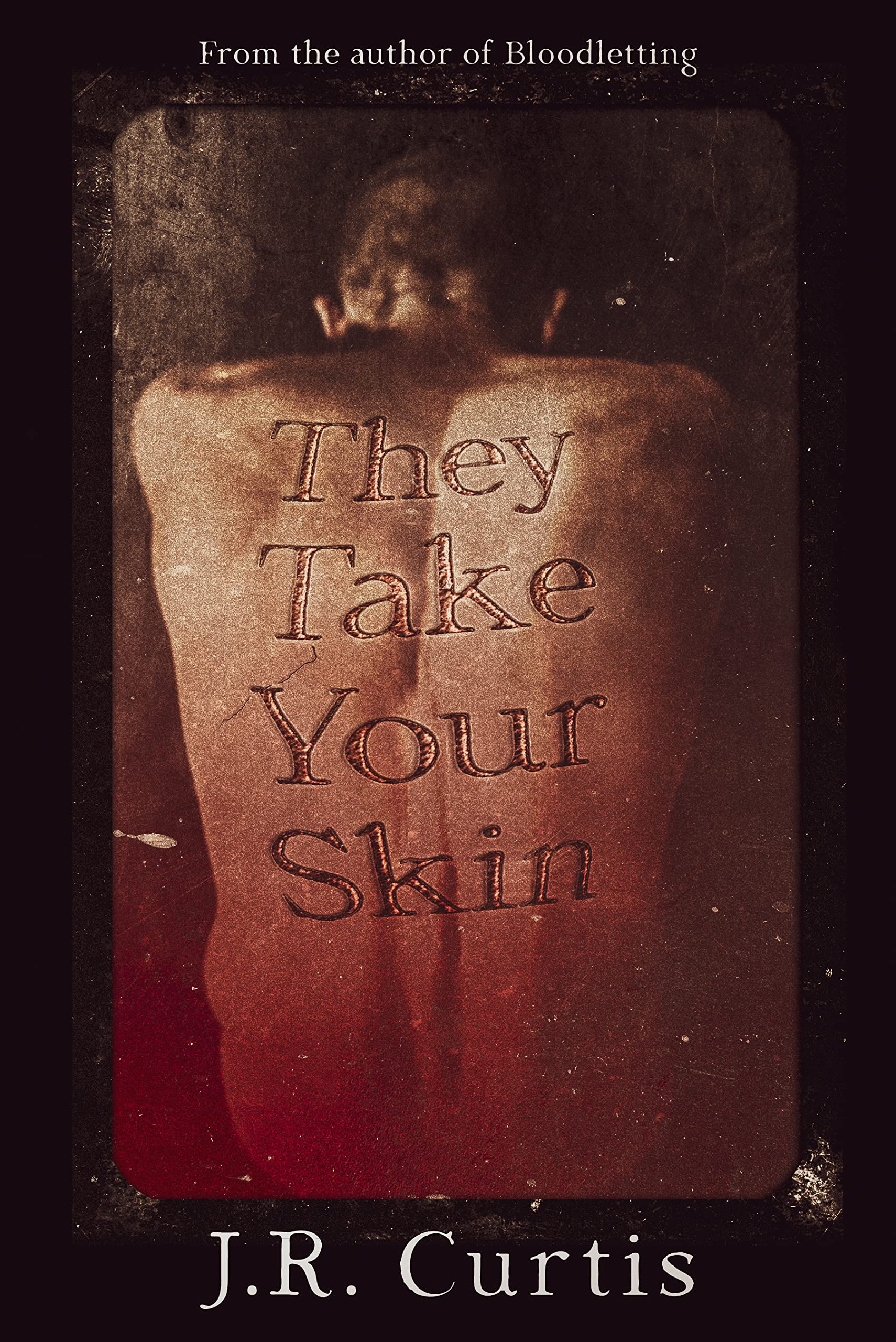 They Take Your Skin