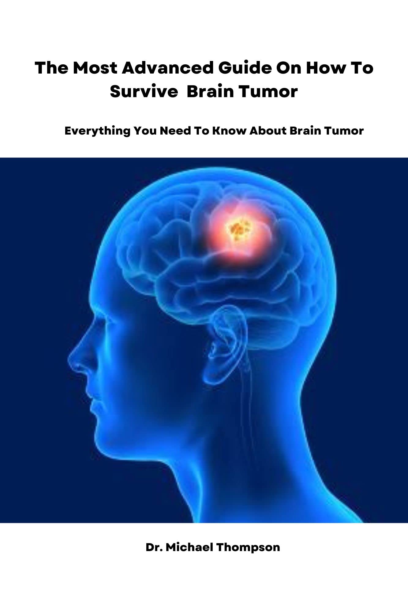the-most-advanced-guide-on-how-to-survive-brain-tumor-everything-you