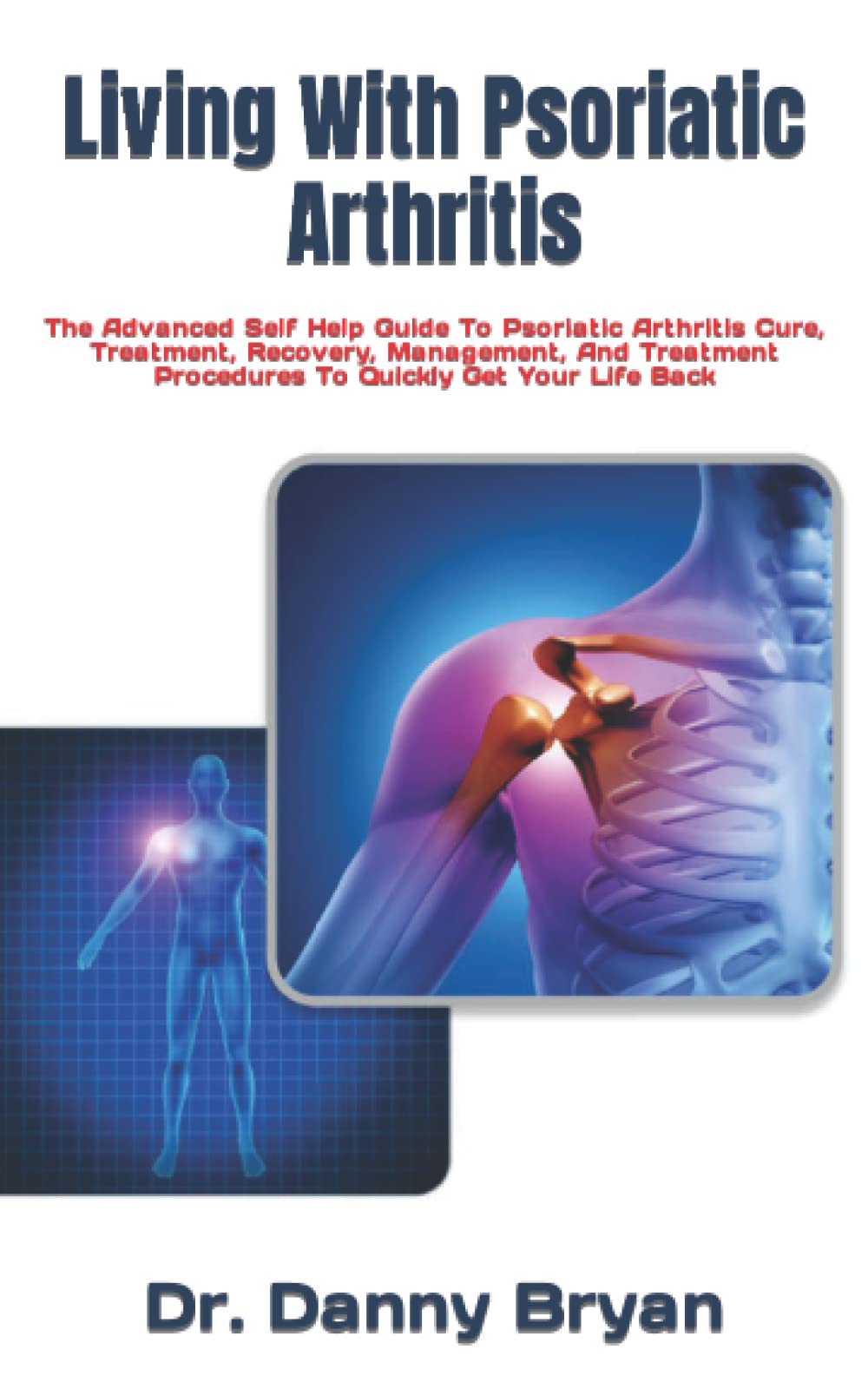 Living With Psoriatic Arthritis The Advanced Self Help Guide To