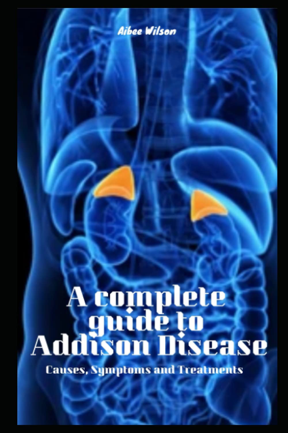 A complete guide to Addison Disease Causes, Symptoms and Treatments by