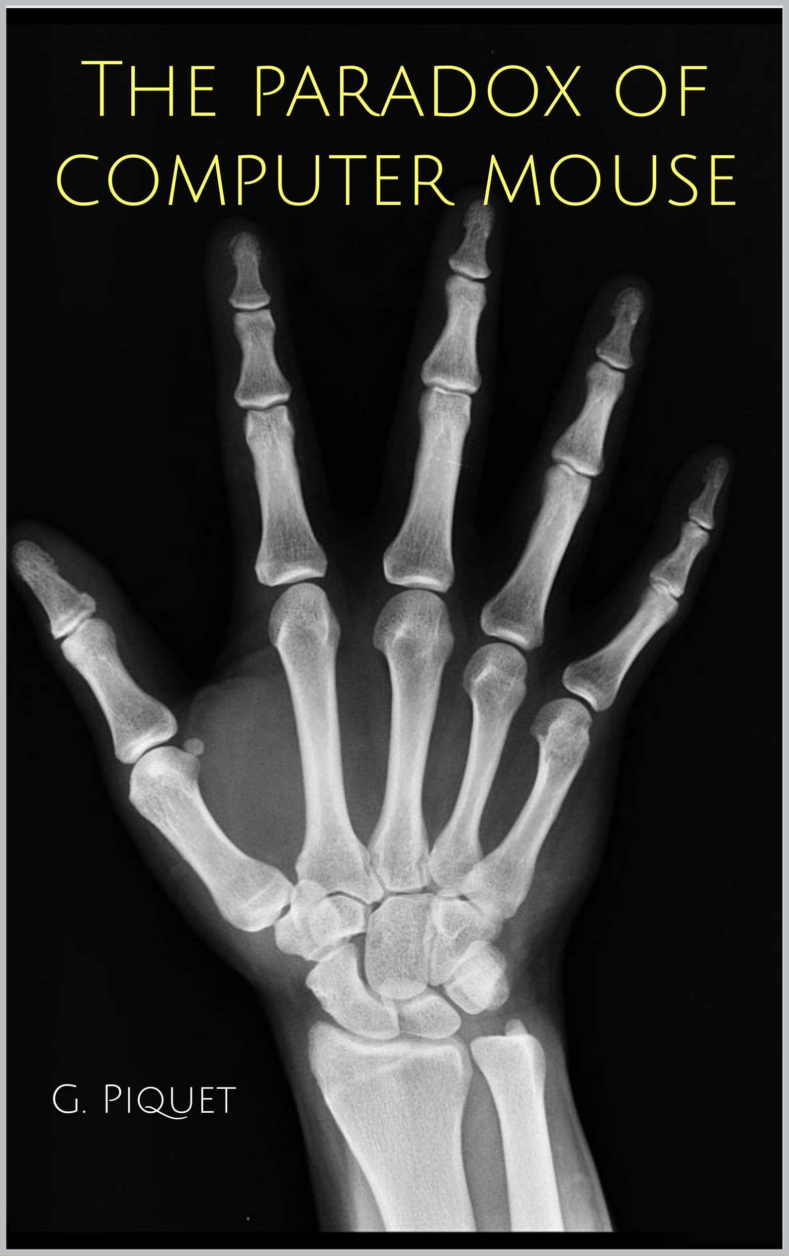 The paradox of computer mouse understanding and preventing Repetitive