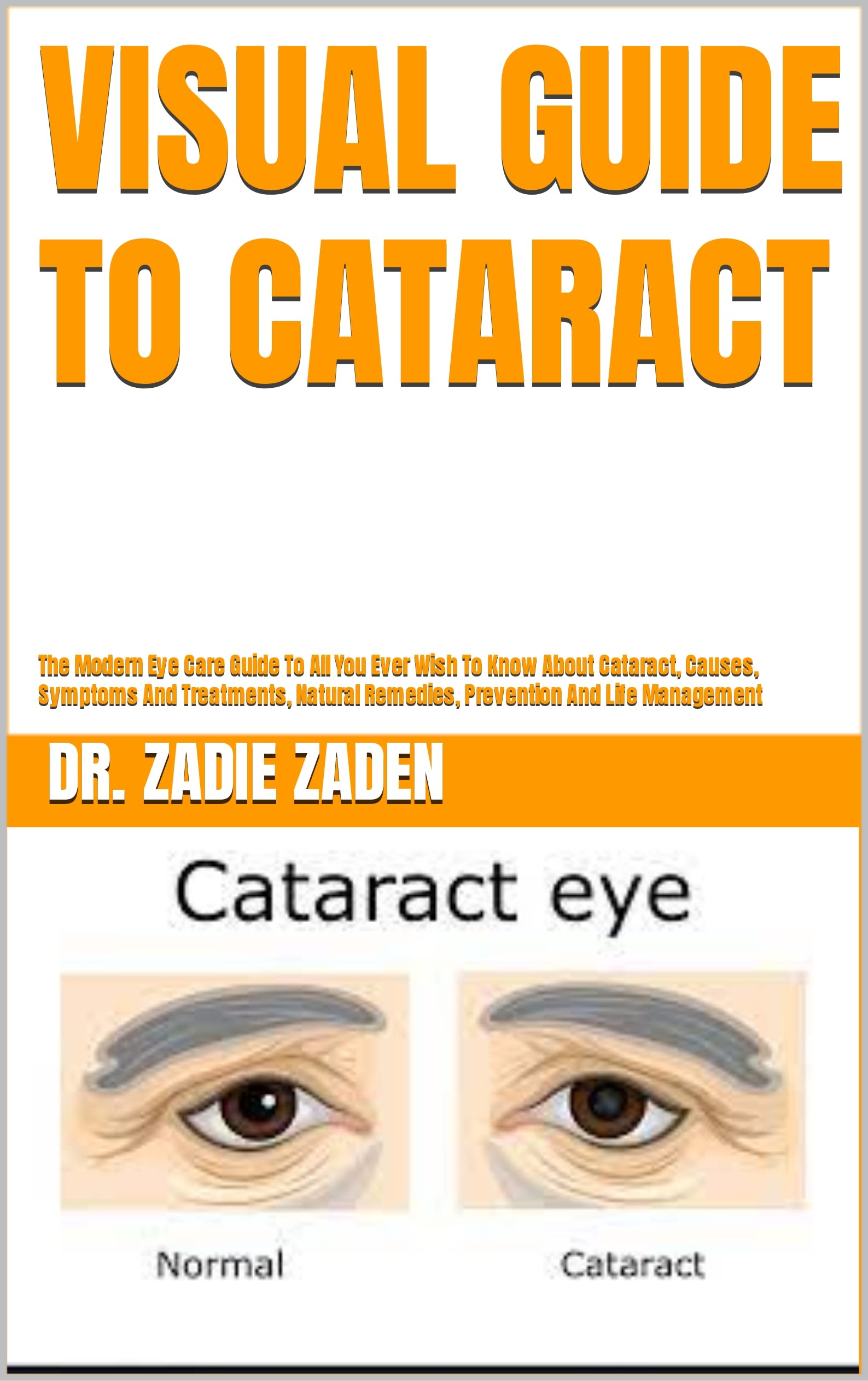 VISUAL GUIDE TO CATARACT The Modern Eye Care Guide To All You Ever