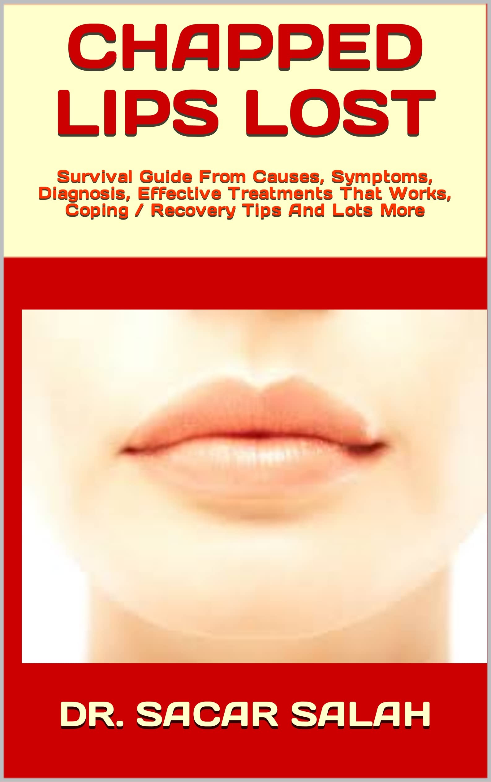 CHAPPED LIPS LOST Survival Guide From Causes, Symptoms, Diagnosis
