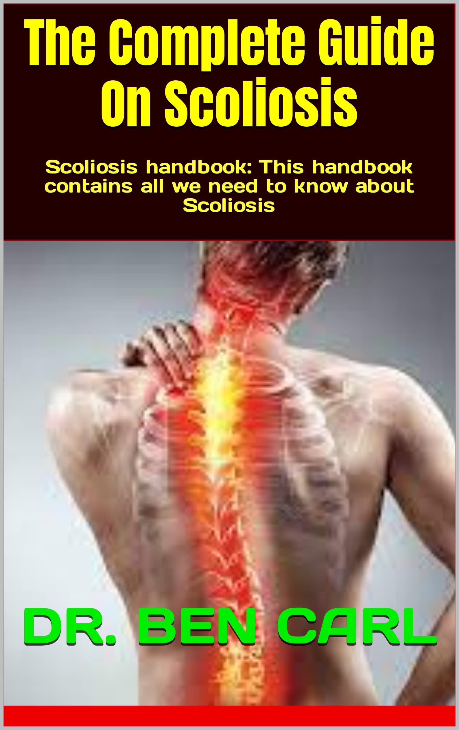 The Complete Guide On Scoliosis. Scoliosis handbook This handbook