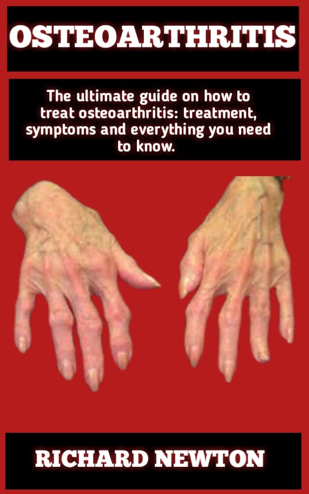 Osteoarthritis Beginners Hand Book Everything You Need To Know To
