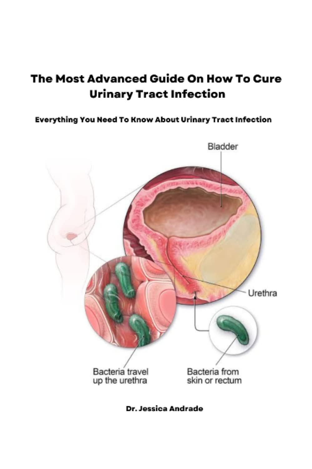 The Most Advanced Guide On How To Cure Urinary Tract Infection