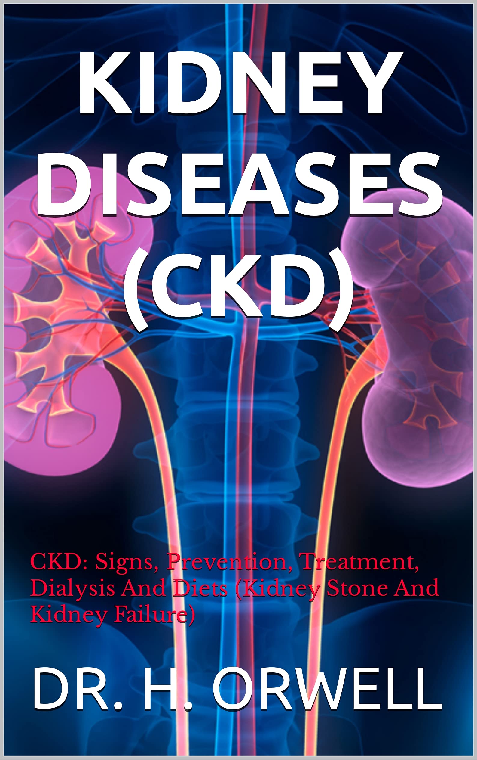 KIDNEY DISEASES (CKD) CKD Signs, Prevention, Treatment, Dialysis And