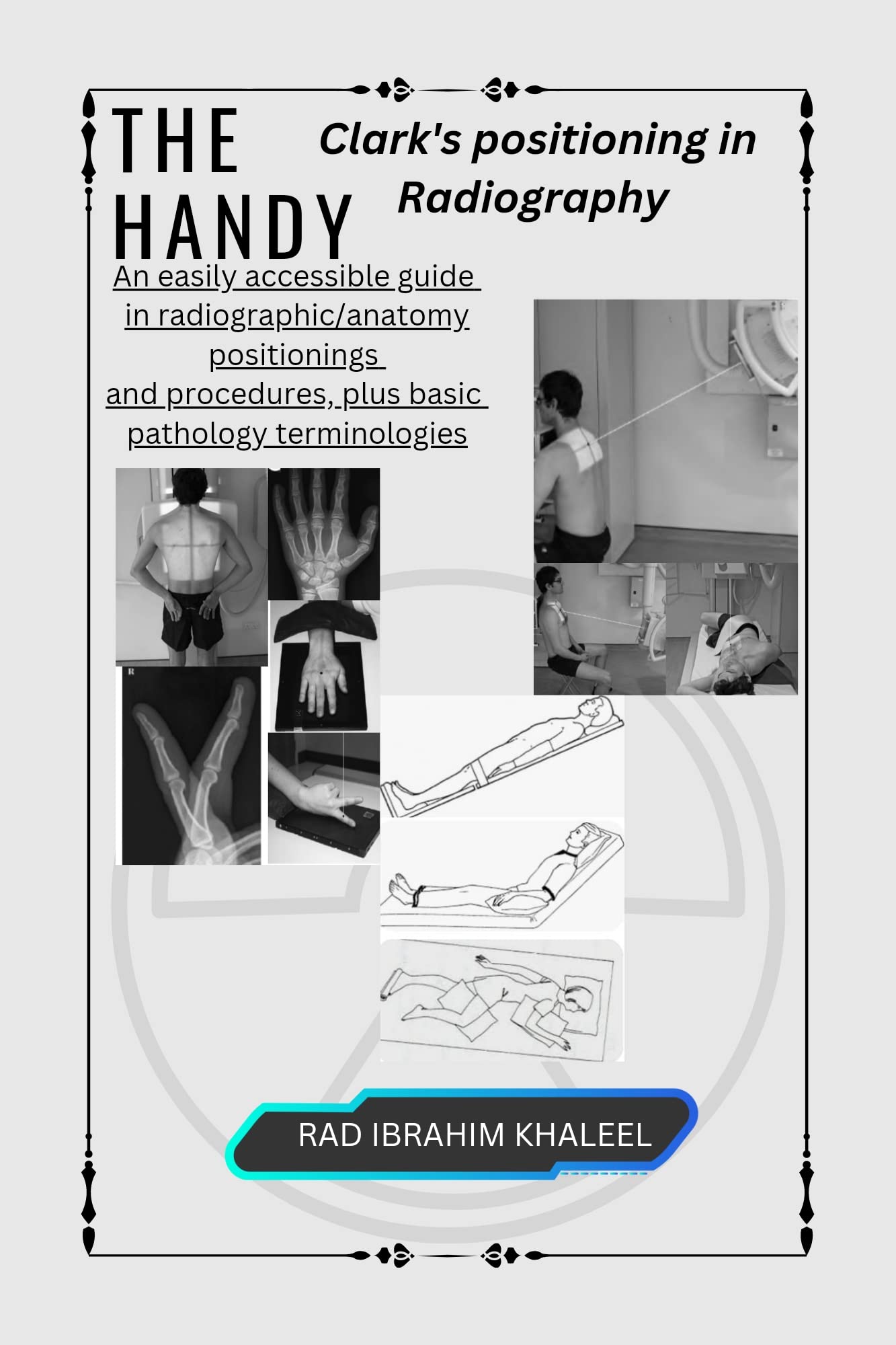 The Handy Clark's positioning in Radiography An easily accessible