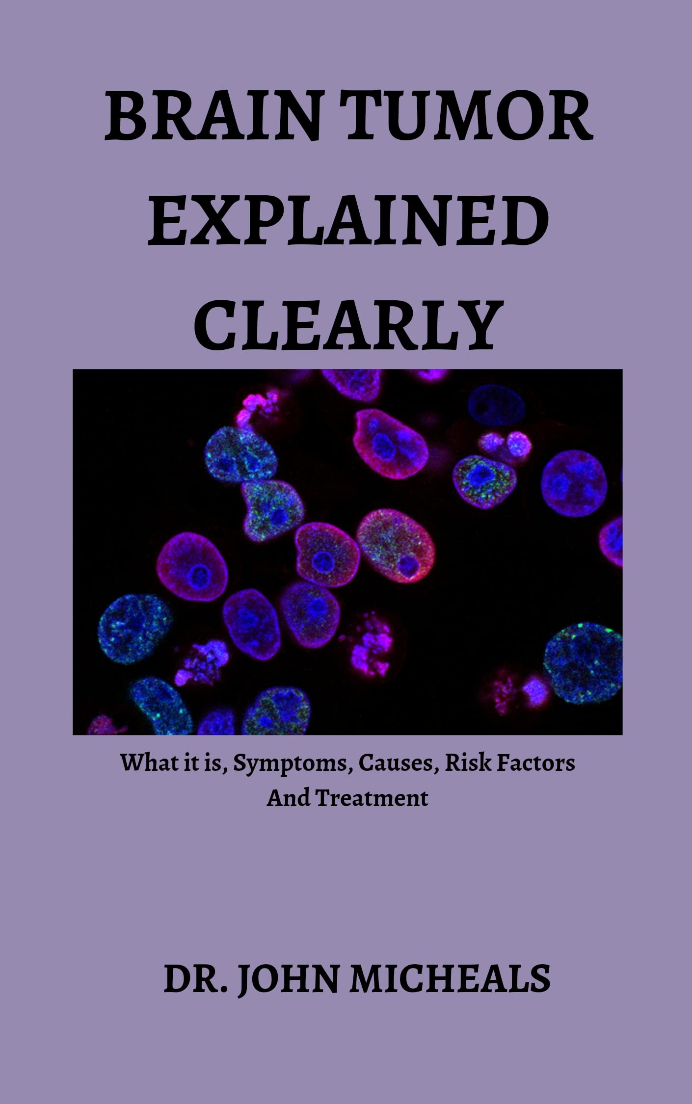 Brain Tumor Explained Clearly What it is, Symptoms, Causes, Risk