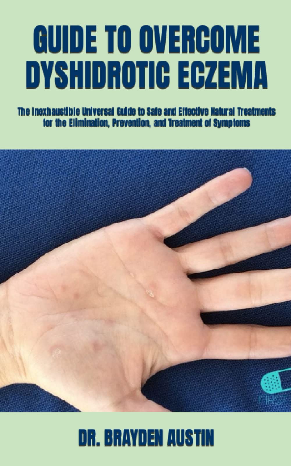 GUIDE TO DYSHIDROTIC ECZEMA The Inexhaustible Universal Guide
