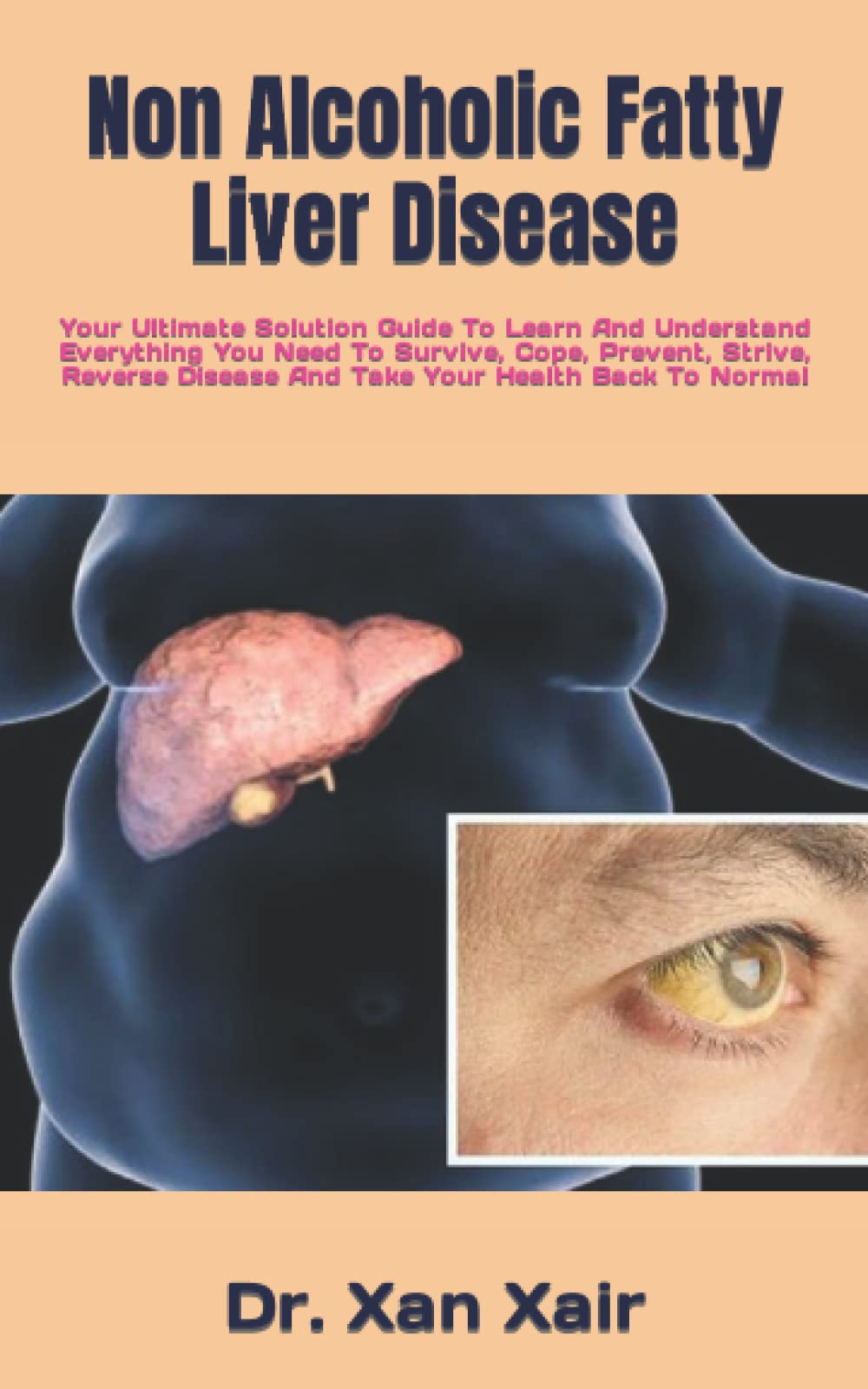 Non Alcoholic Fatty Liver Disease: Your Ultimate Solution Guide To ...